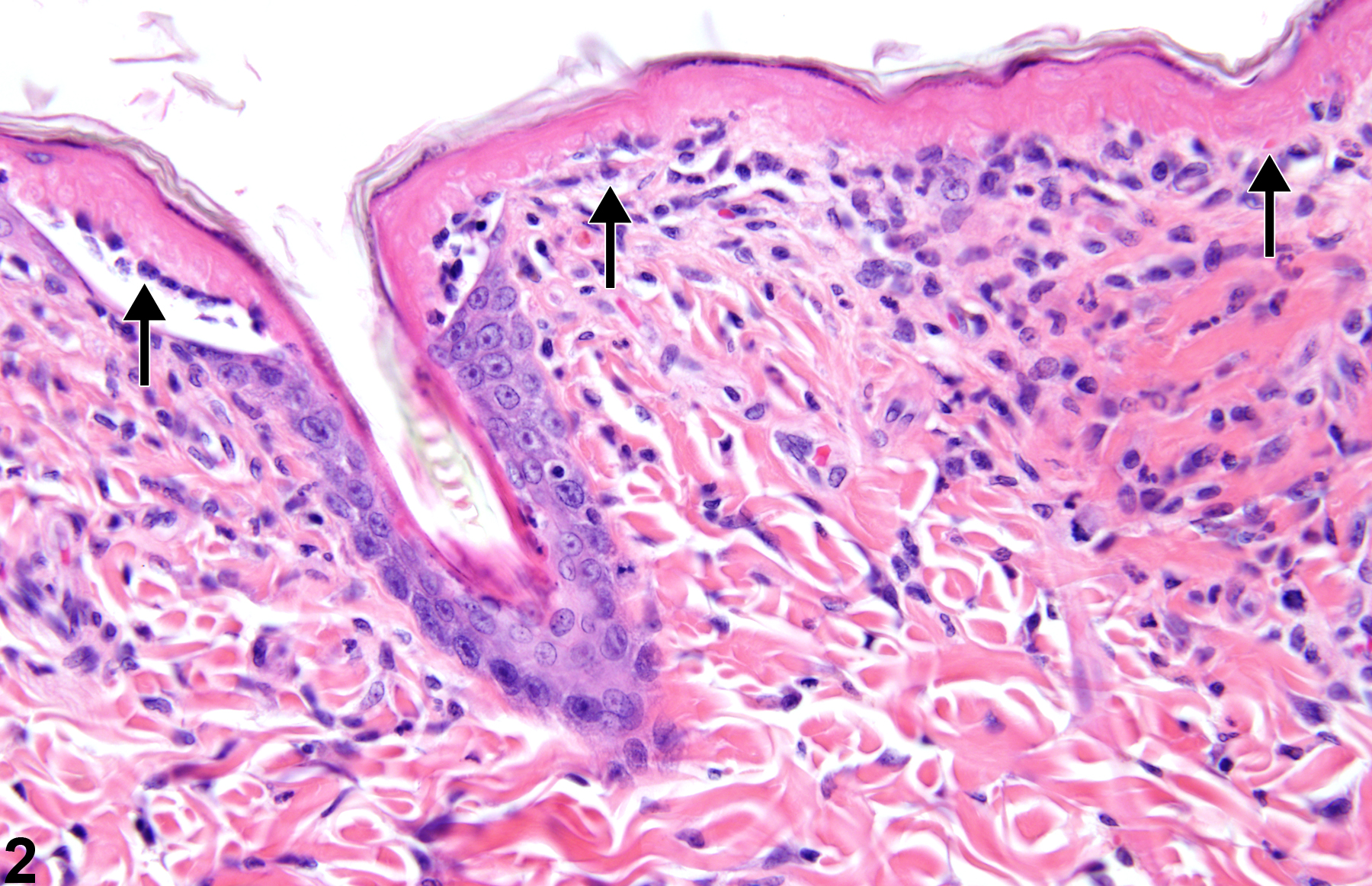 Image of Necrosis in the Skin from a Male F344/N Rat in a 90-day  Study