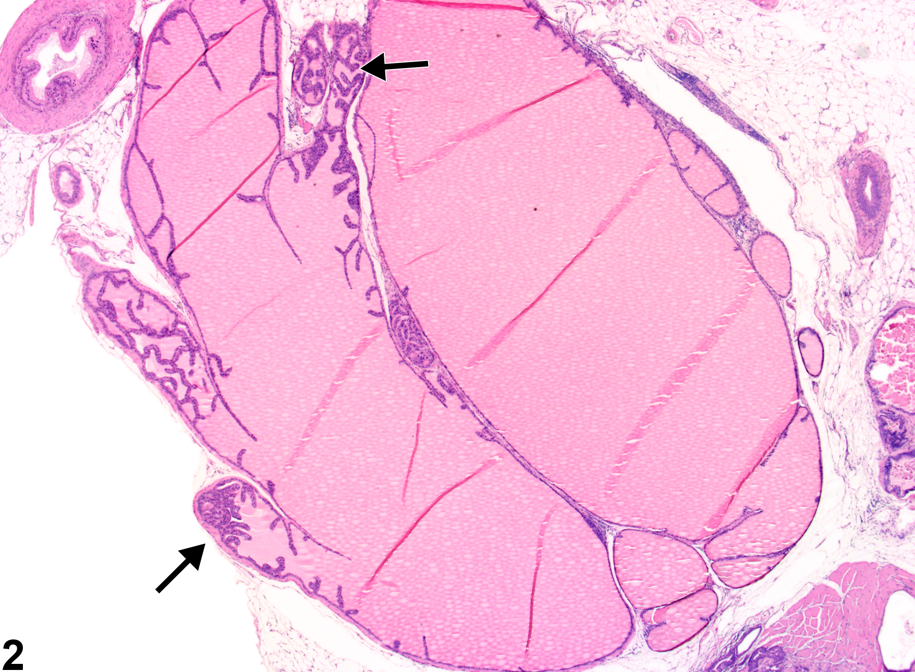 Image of dilation, acinar in the coagulating gland from a male B6C3F1 mouse in a chronic study