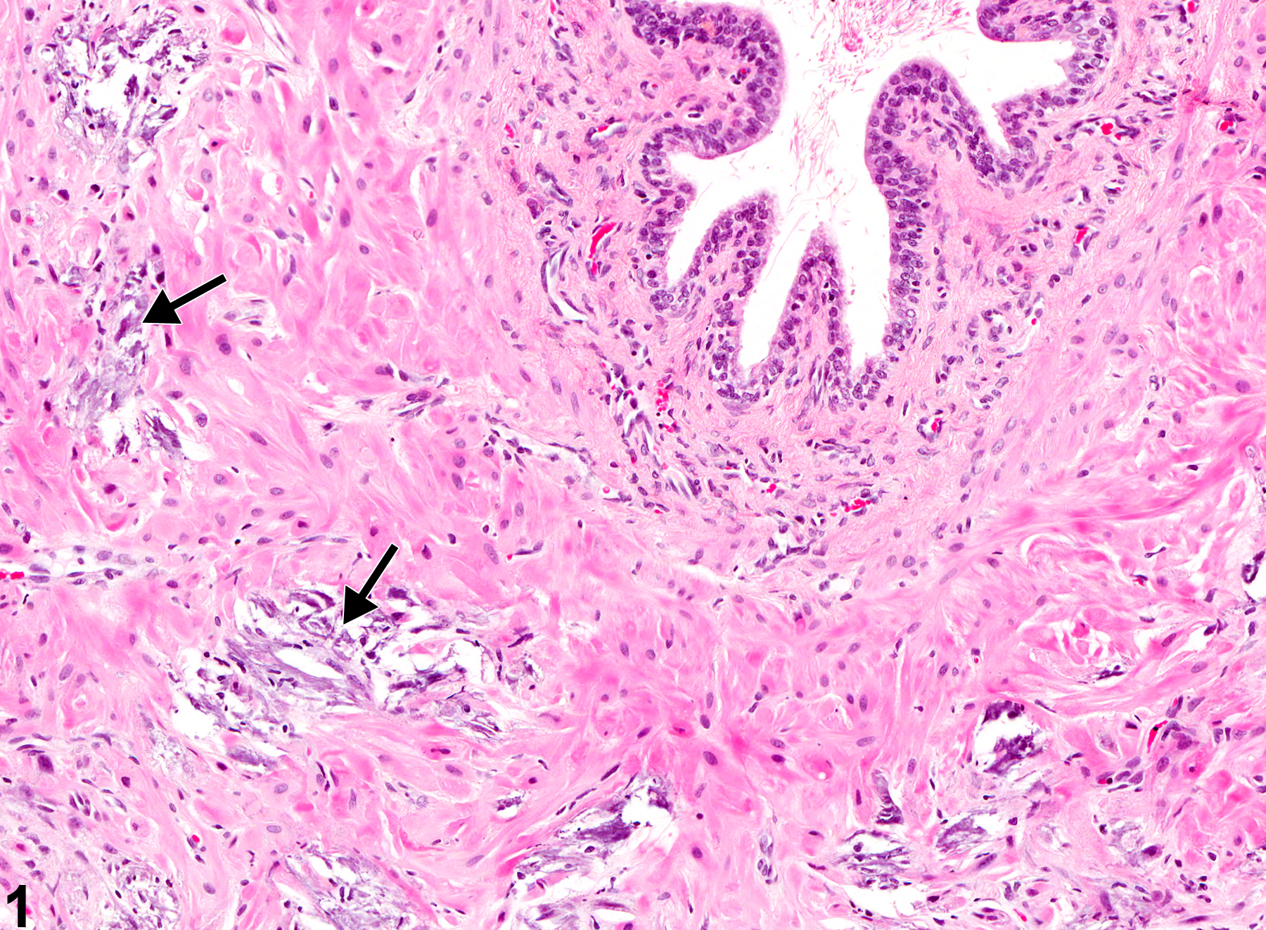 Image of mineralization in the ductus deferens from a male B6C3F1 mouse in a chronic study