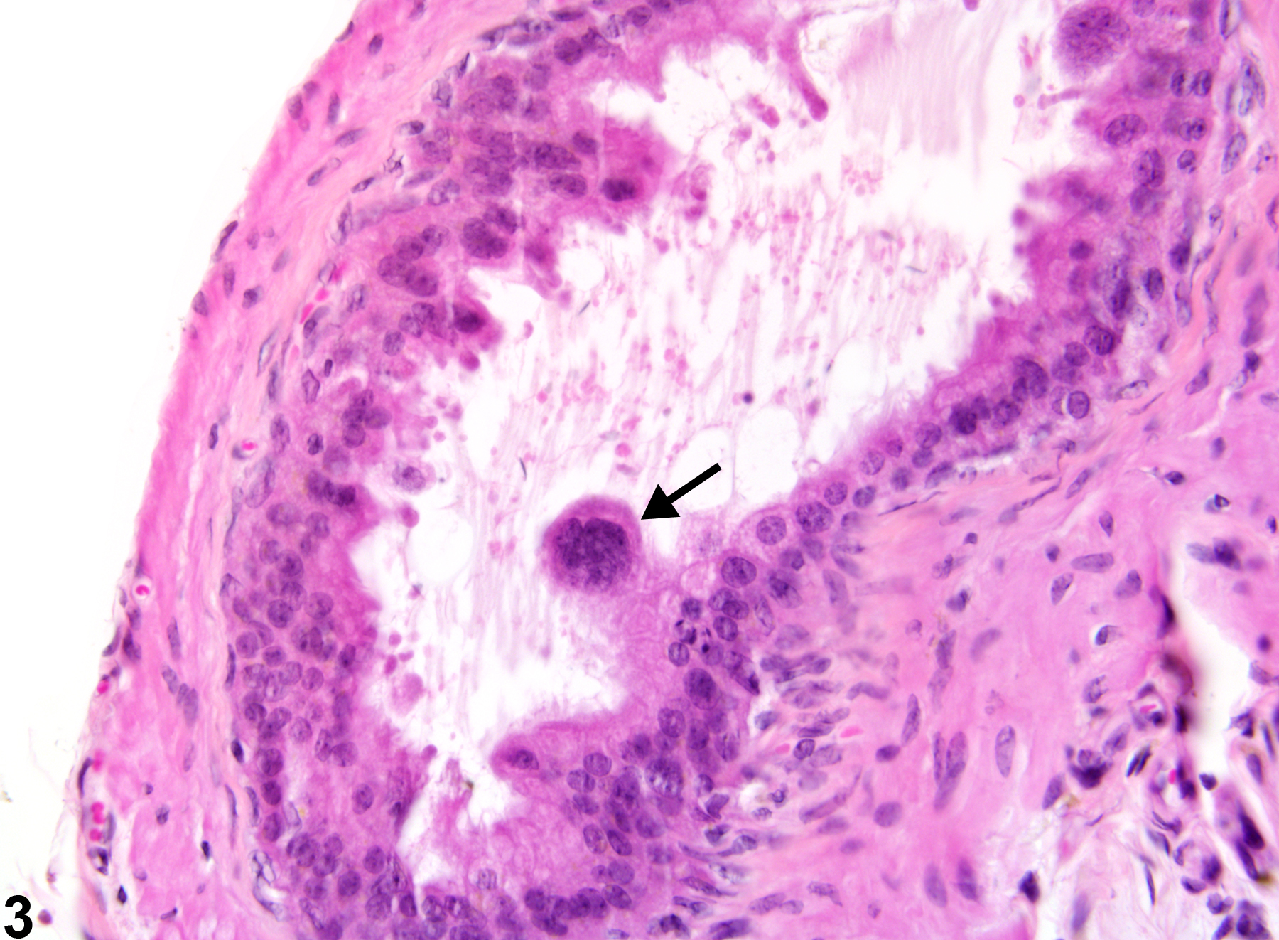 Image of epithelial karyomegaly in the epididymis from a male B6C3F1 mouse in a chronic study