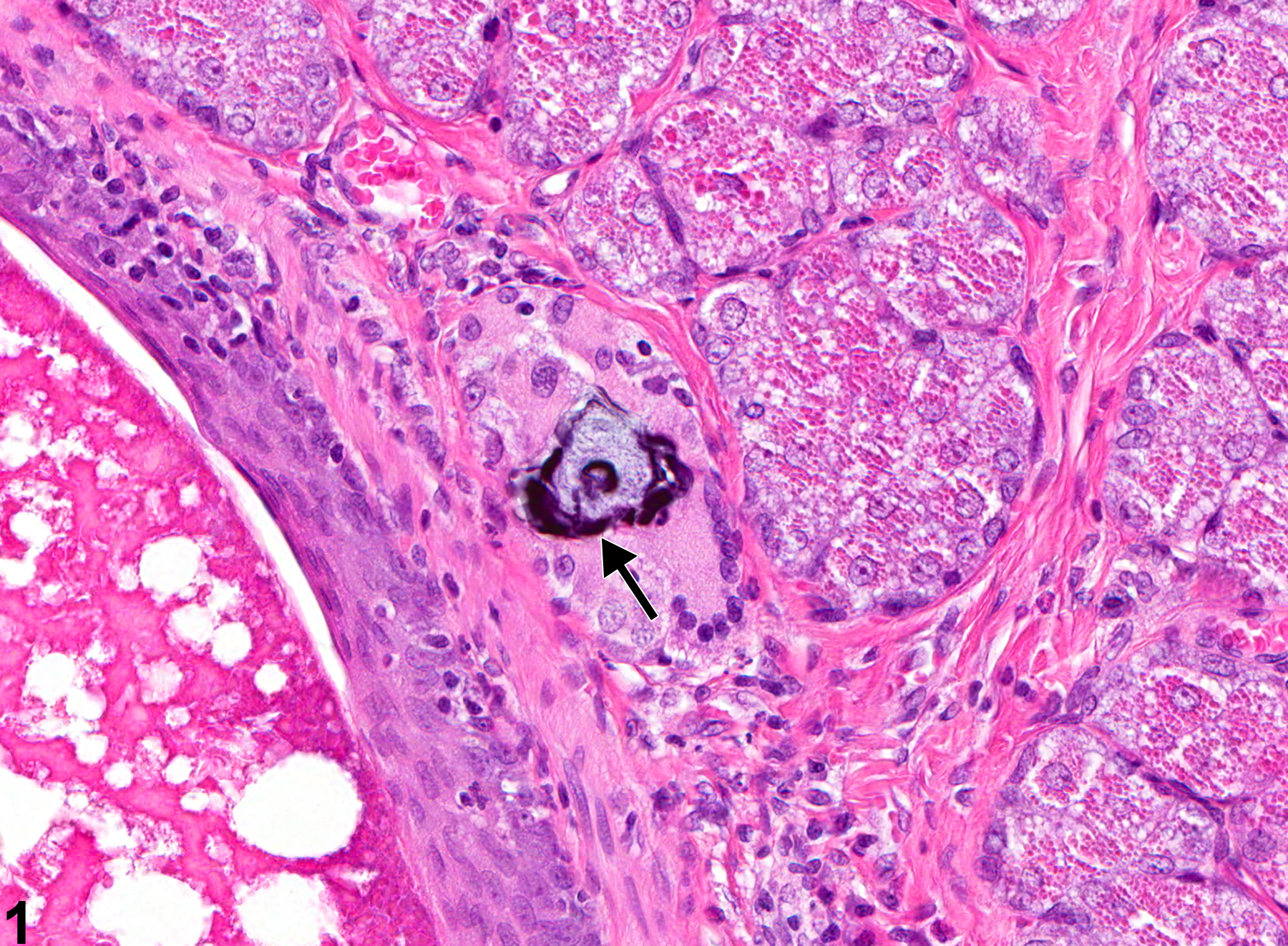Image of mineralization in the preputial gland from a male F344/N rat in a subchronic study
