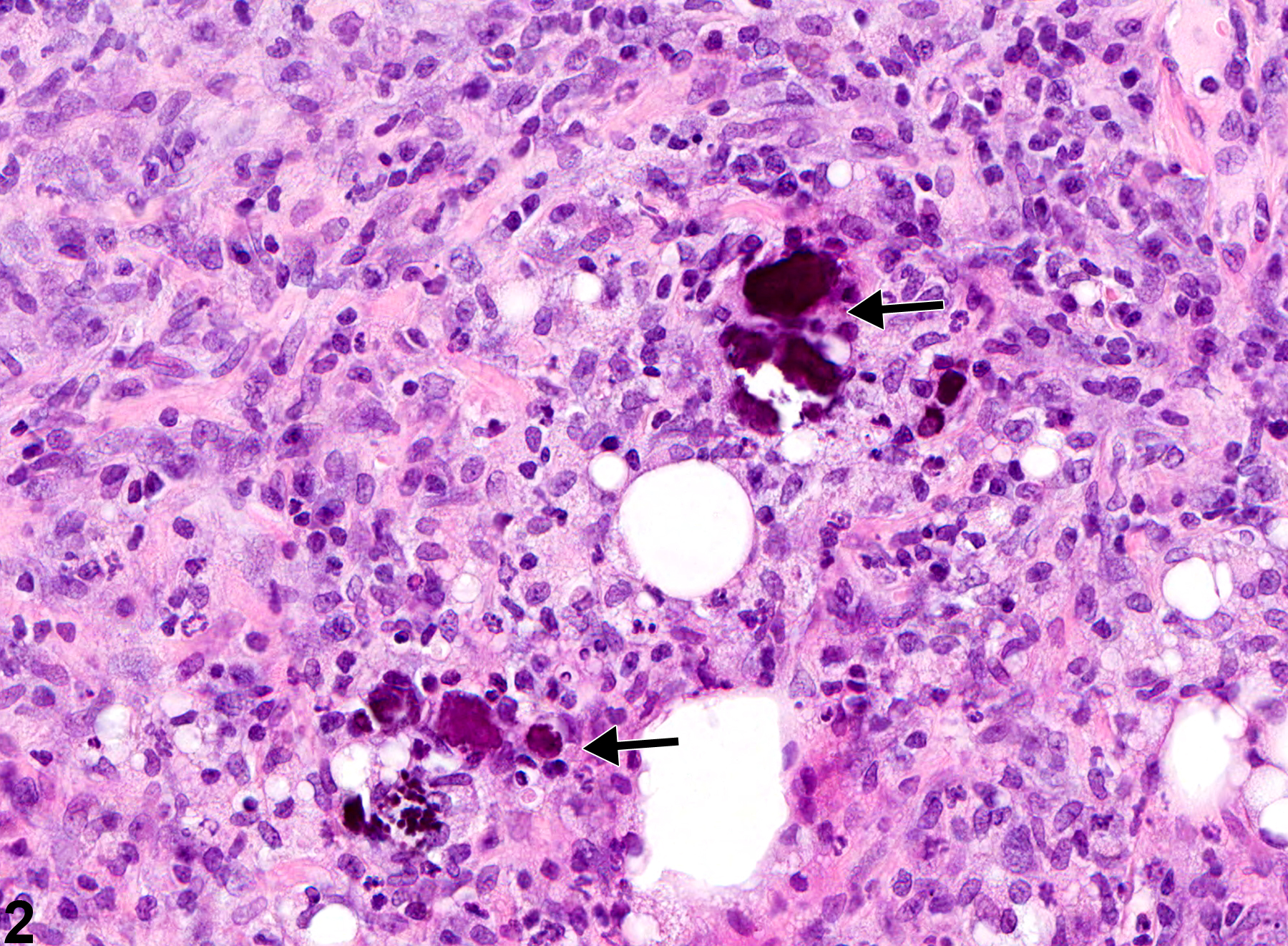 Image of mineralization in the preputial gland from a male F344/N rat in a subchronic study