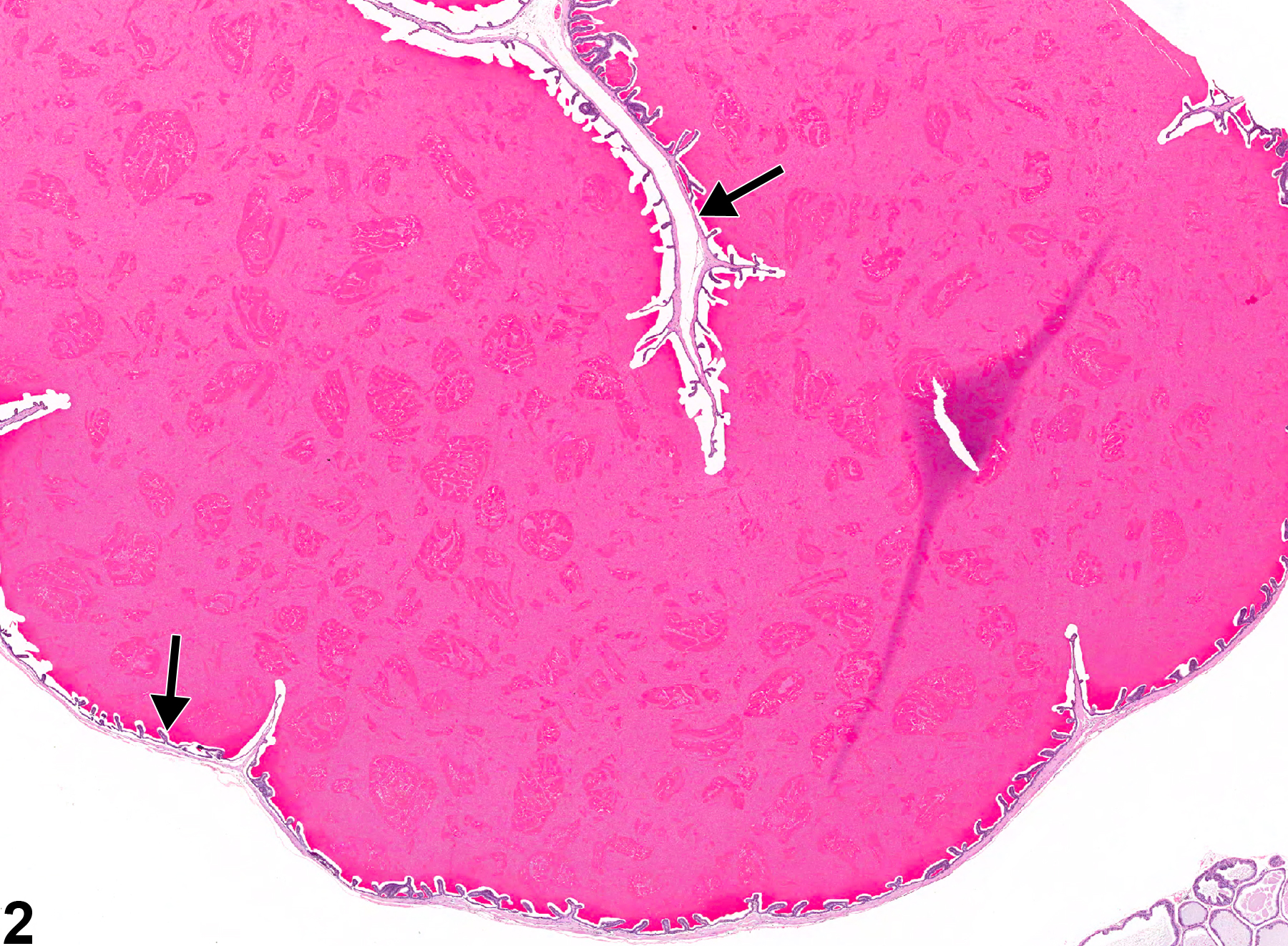 Image of dilation in the seminal vesicle from a male F344/N rat in an chronic study