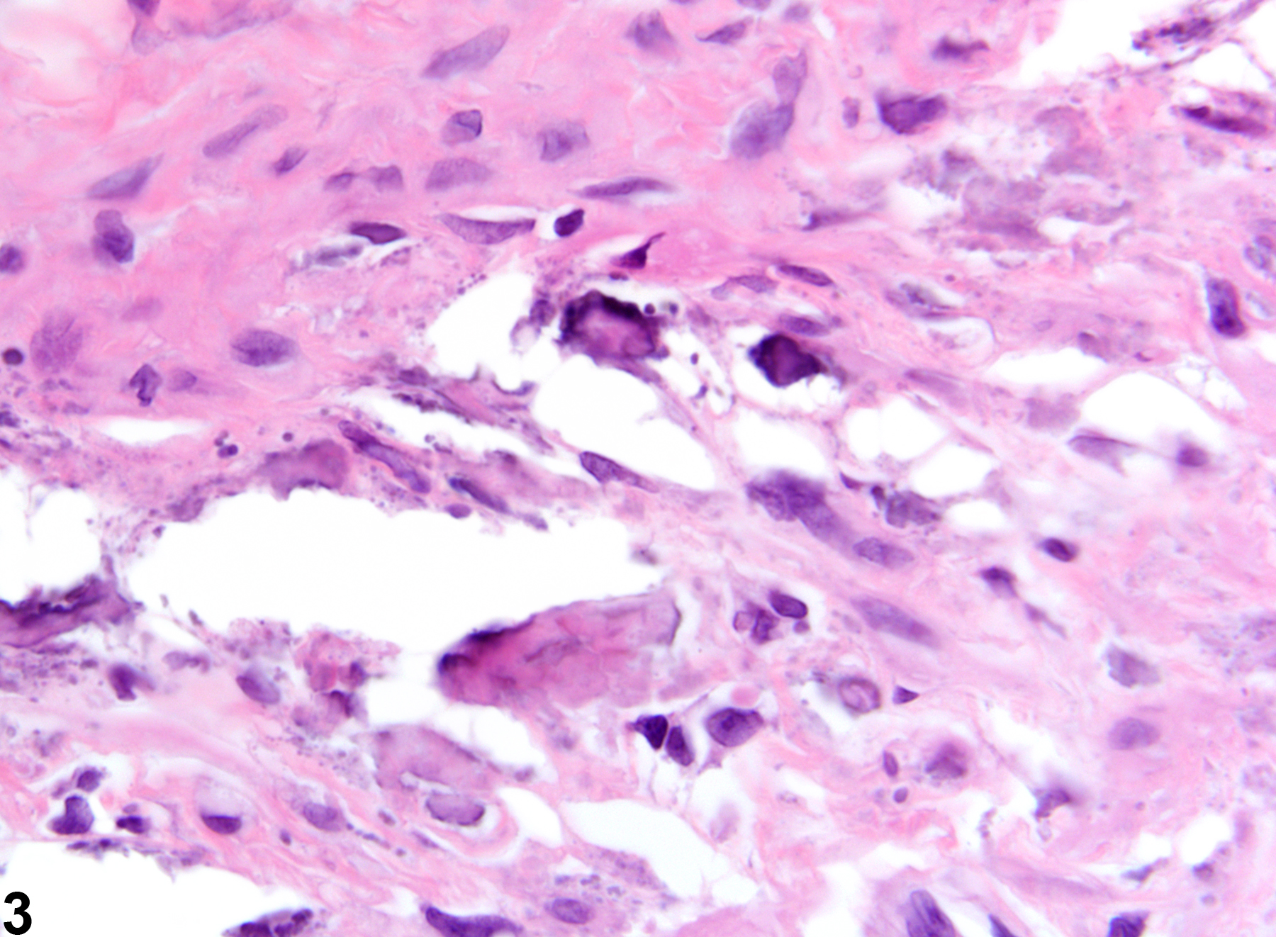 Image of mineralization in the seminal vesicle from a male F344/N rat in an chronic study
