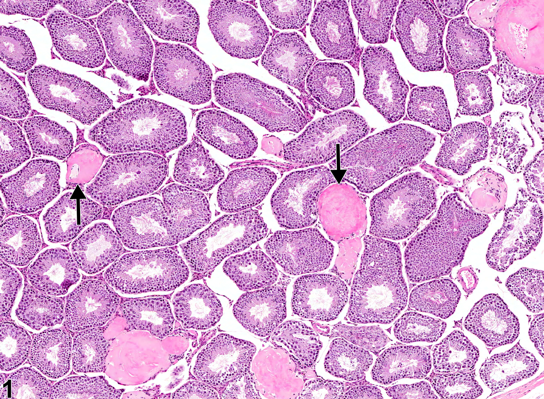 Image of amyloid in the testis from a male B6C3F1 mouse in a chronic study