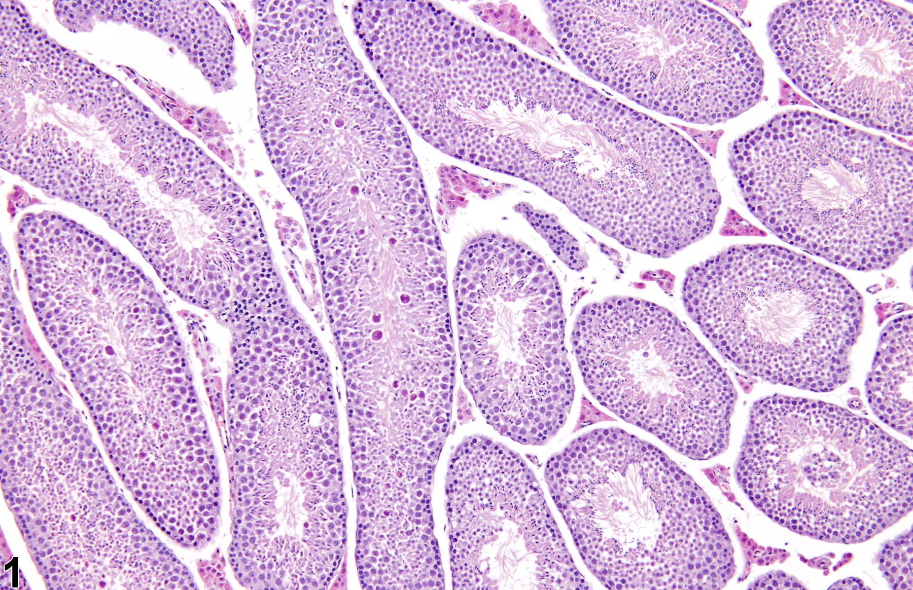 Image of atypical residual bodies in the testis from a male B6C3F1 mouse in a subchronic study