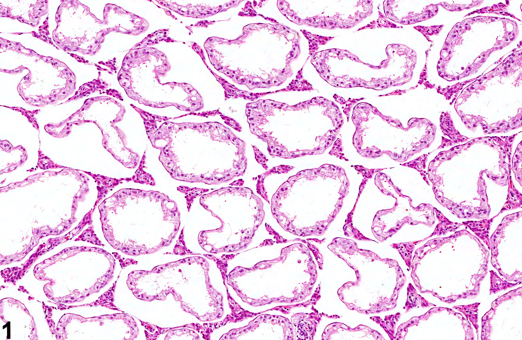 Image of germinal epithelium atrophy in the testis from a male F344/N rat in a subchronic study