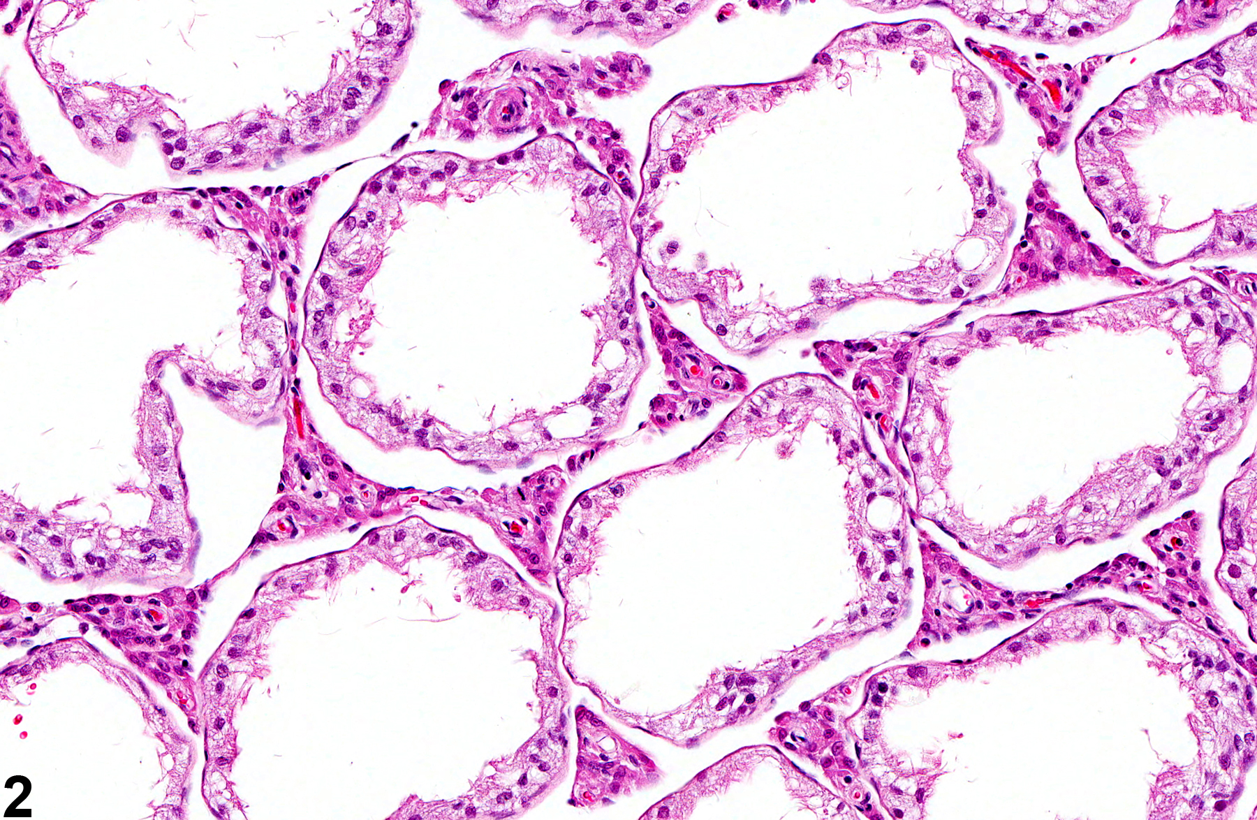 Image of germinal epithelium atrophy in the testis from a male F344/N rat in a subchronic study
