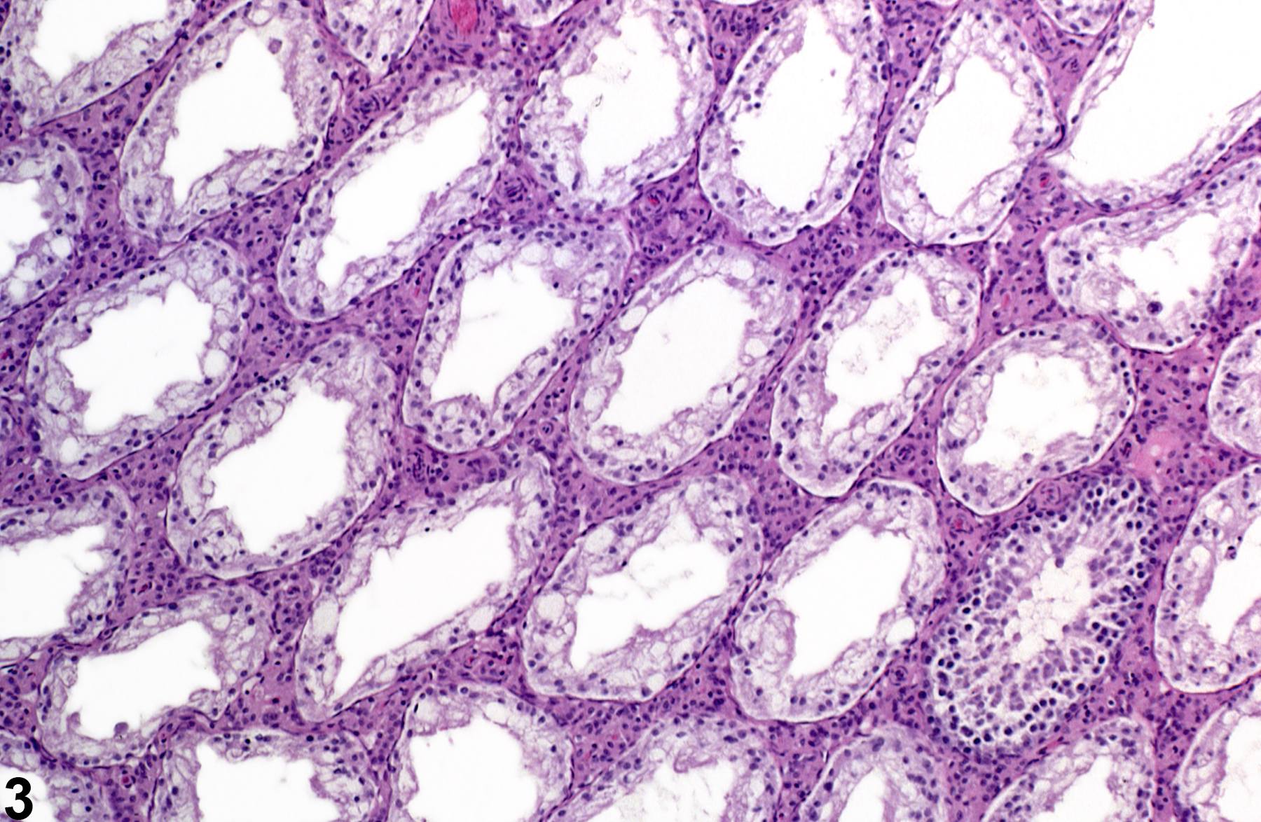 Image of germinal epithelium atrophy in the testis from a male F344/N rat in a chronic study