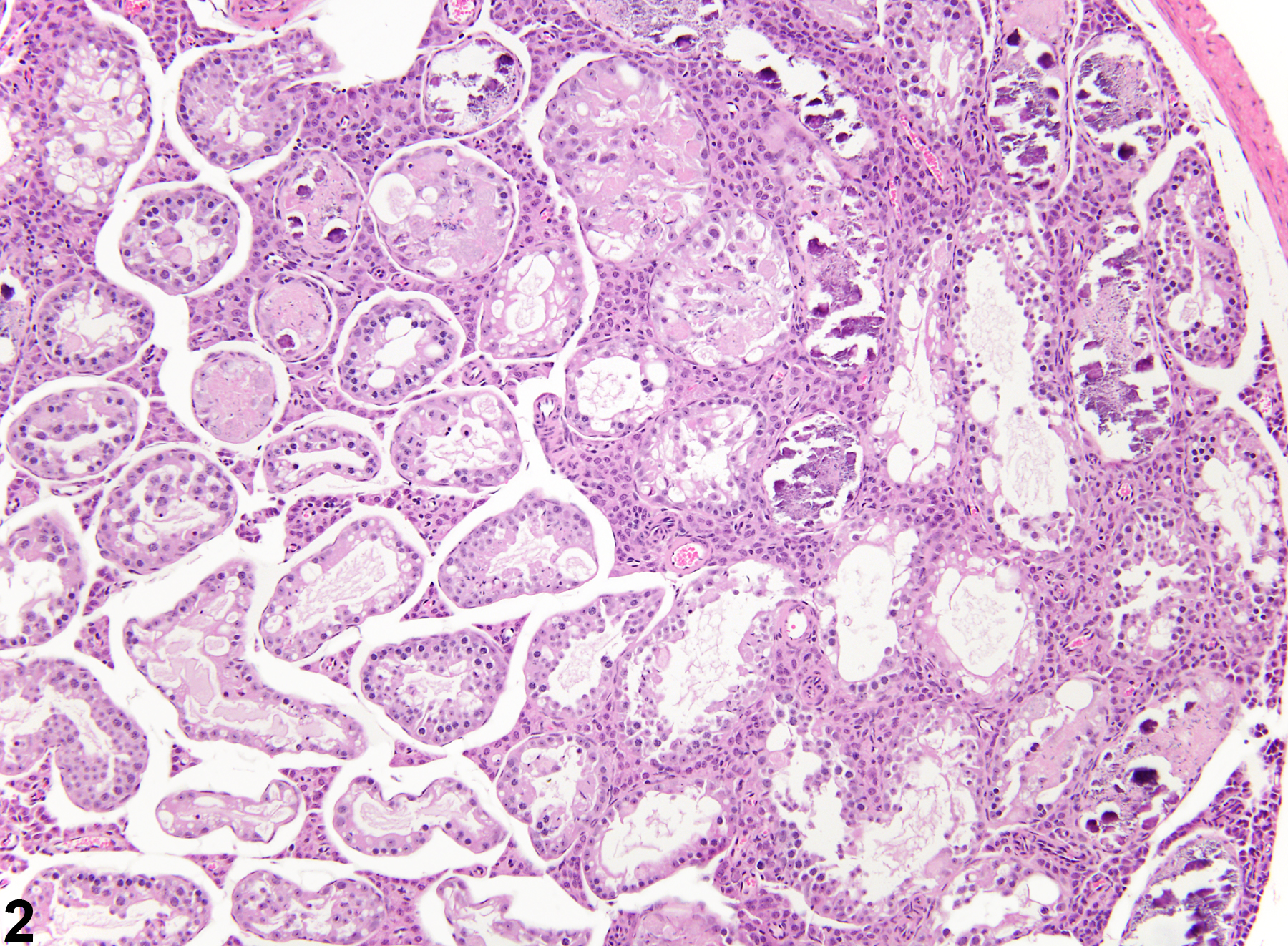 Image of mineralization in the testis from a male B6C3F1 mouse in a chronic study