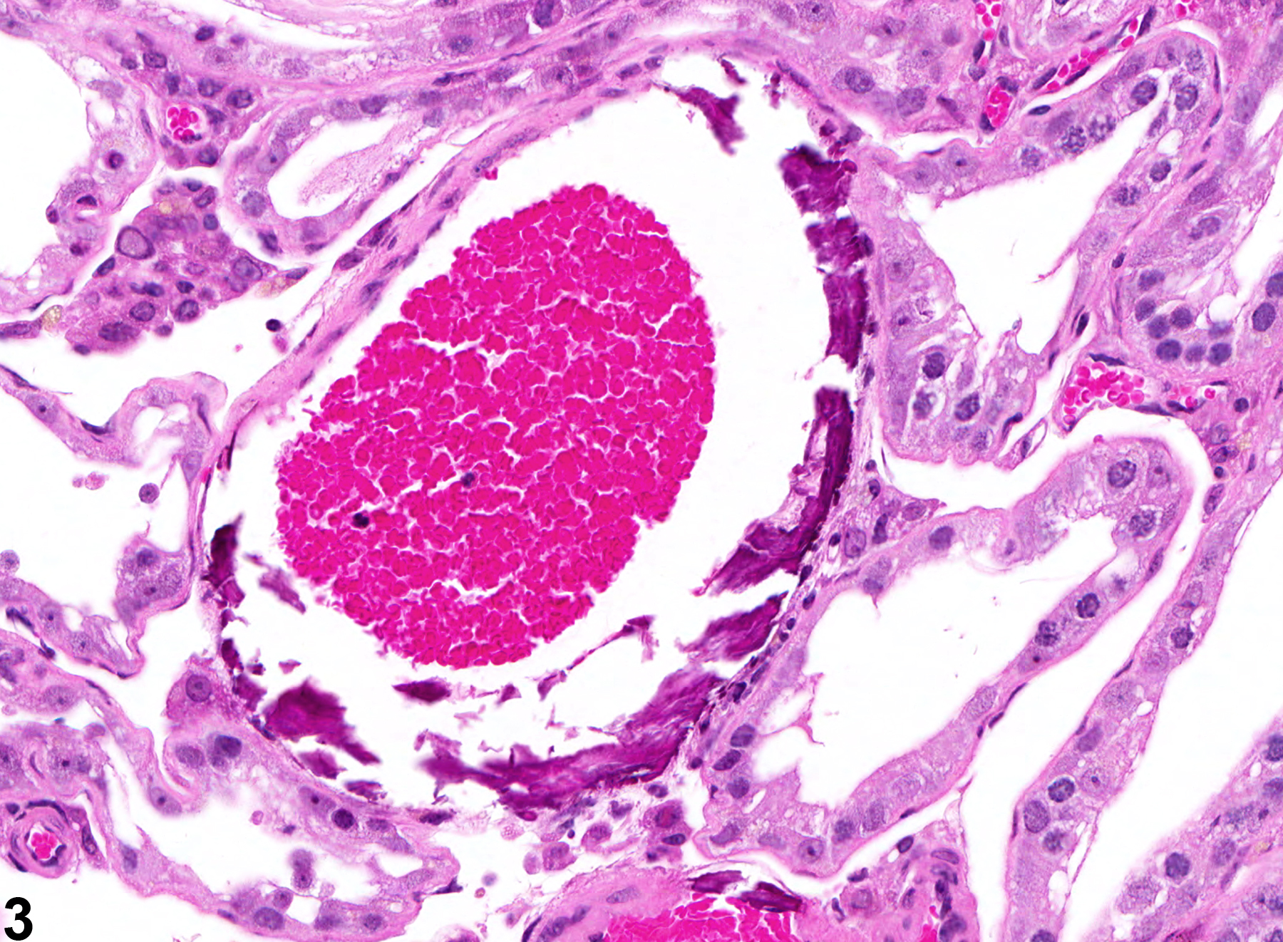 Image of mineralization in the testis from a male F344/N rat in a chronic study
