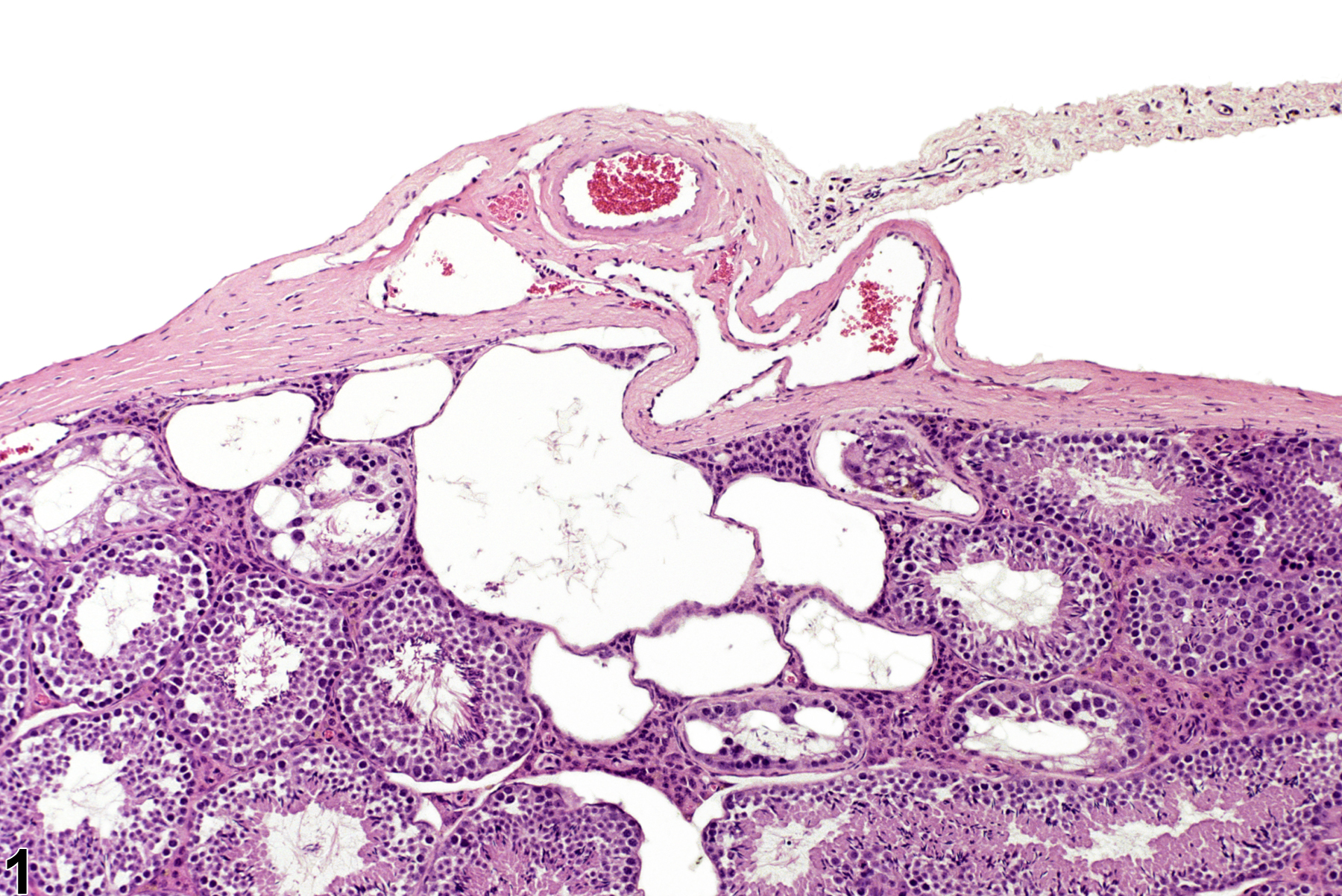 Image of rete testis dilation in the testis from a male B6C3F1 mouse in a chronic study