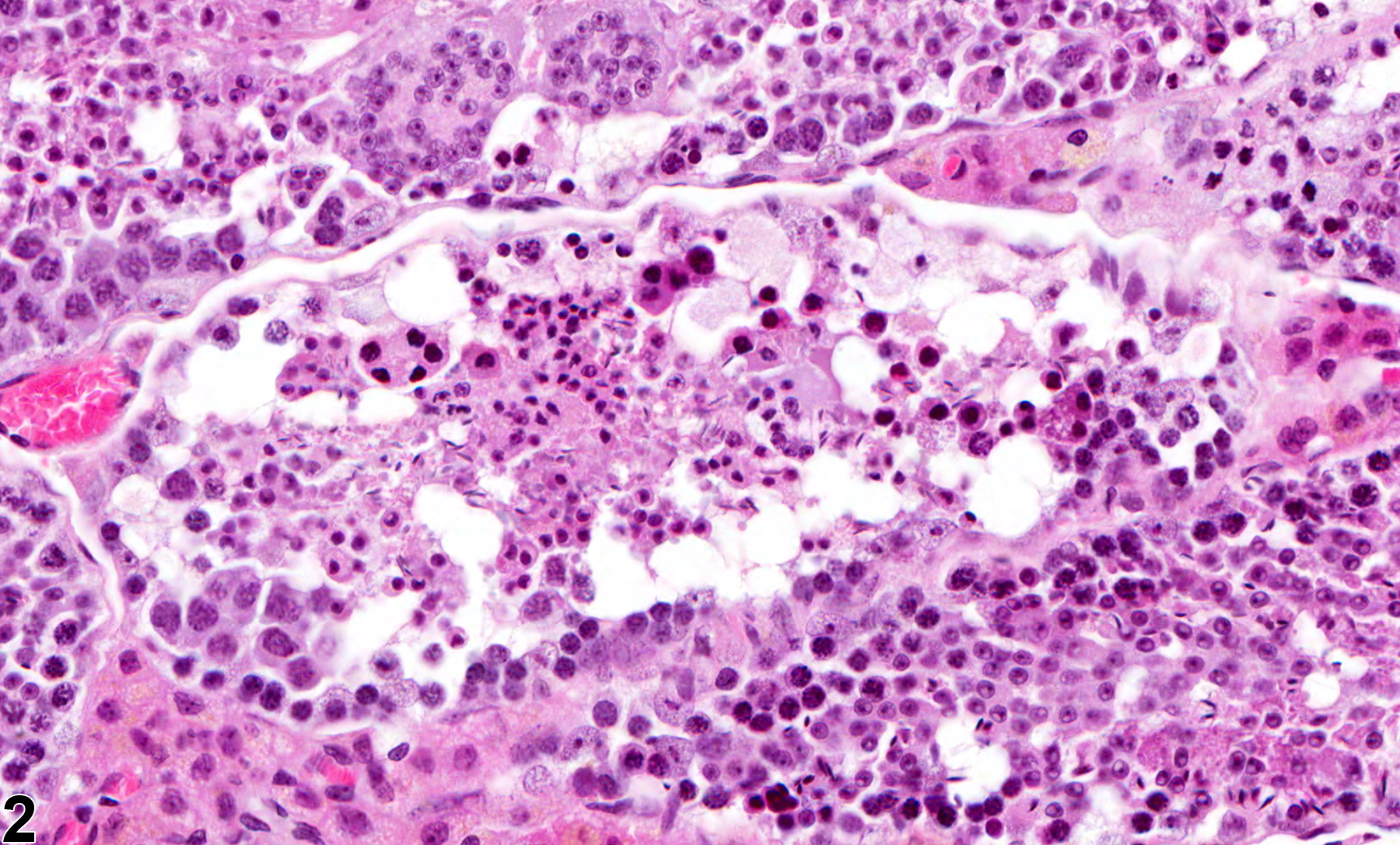 Image of seminiferous tubule necrosis in the testis from a male Swiss Webster mouse in a chronic study