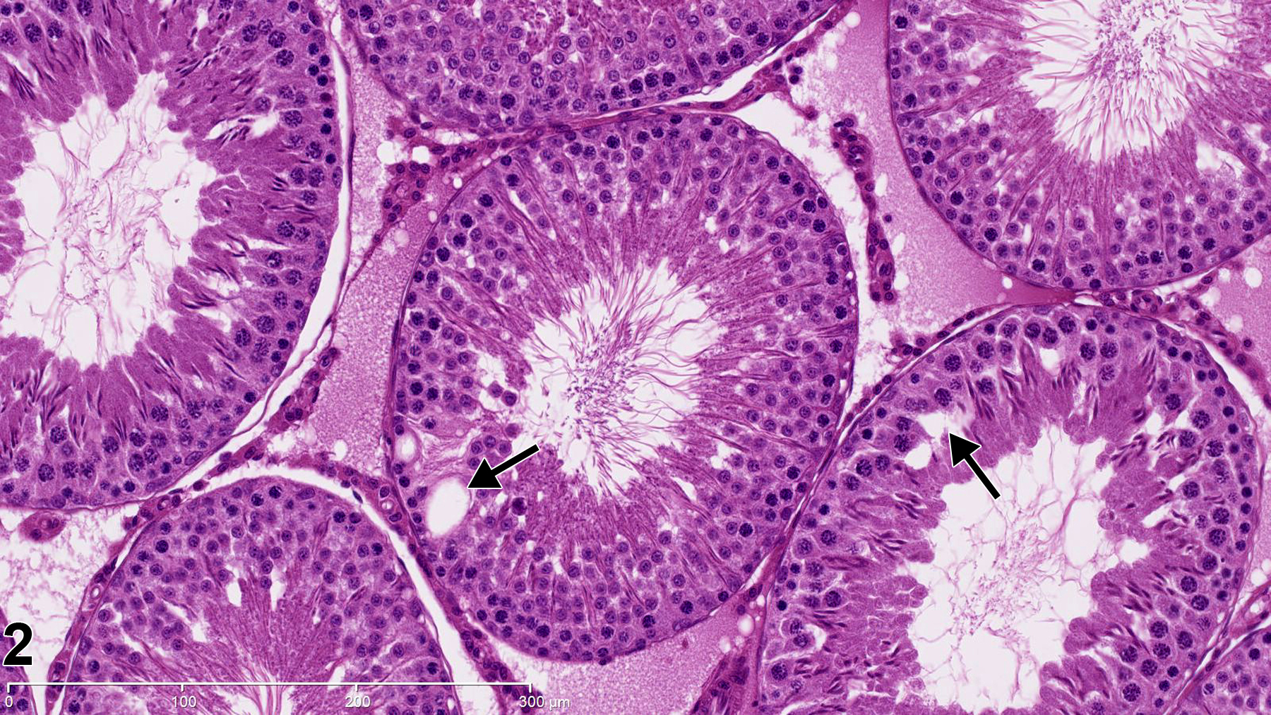Image of seminiferous tubule vacuolation in the testis from a male Harlan Sprague-Dawley rat