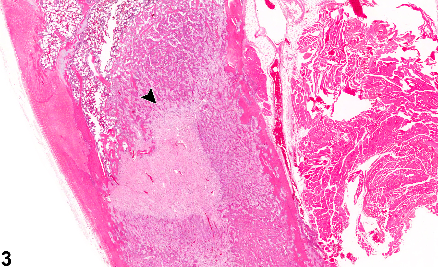 Image of callus in the bone from a male F344/N rat in a chronic study