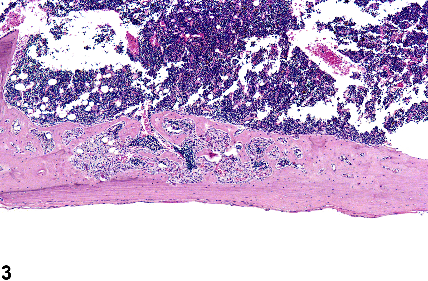 Image of fibro-osseous lesion in the bone from a female B6C3F1/N mouse in a chronic study
