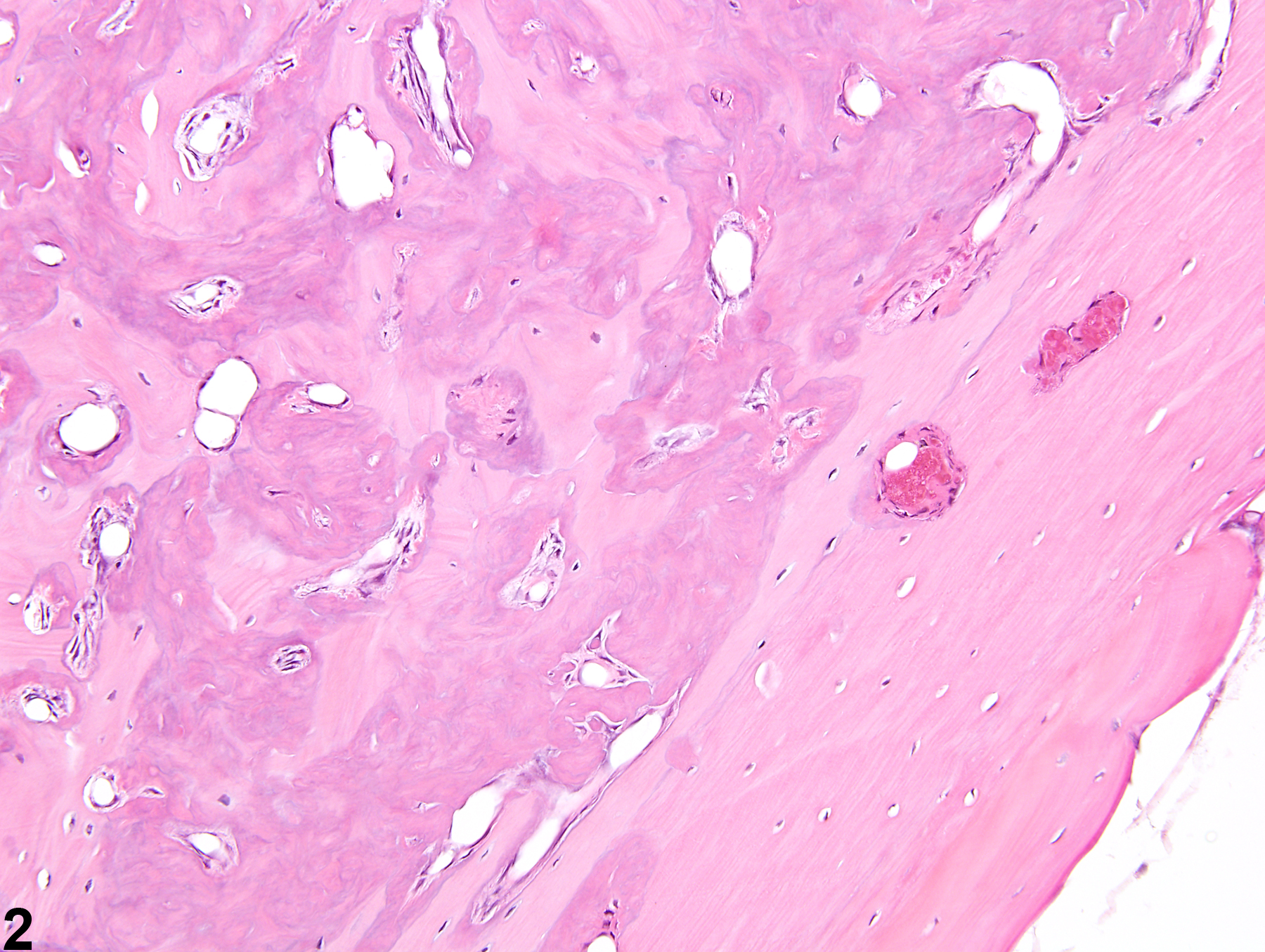 Image of increased bone in the bone from a female B6C3F1/N mouse in a chronic study