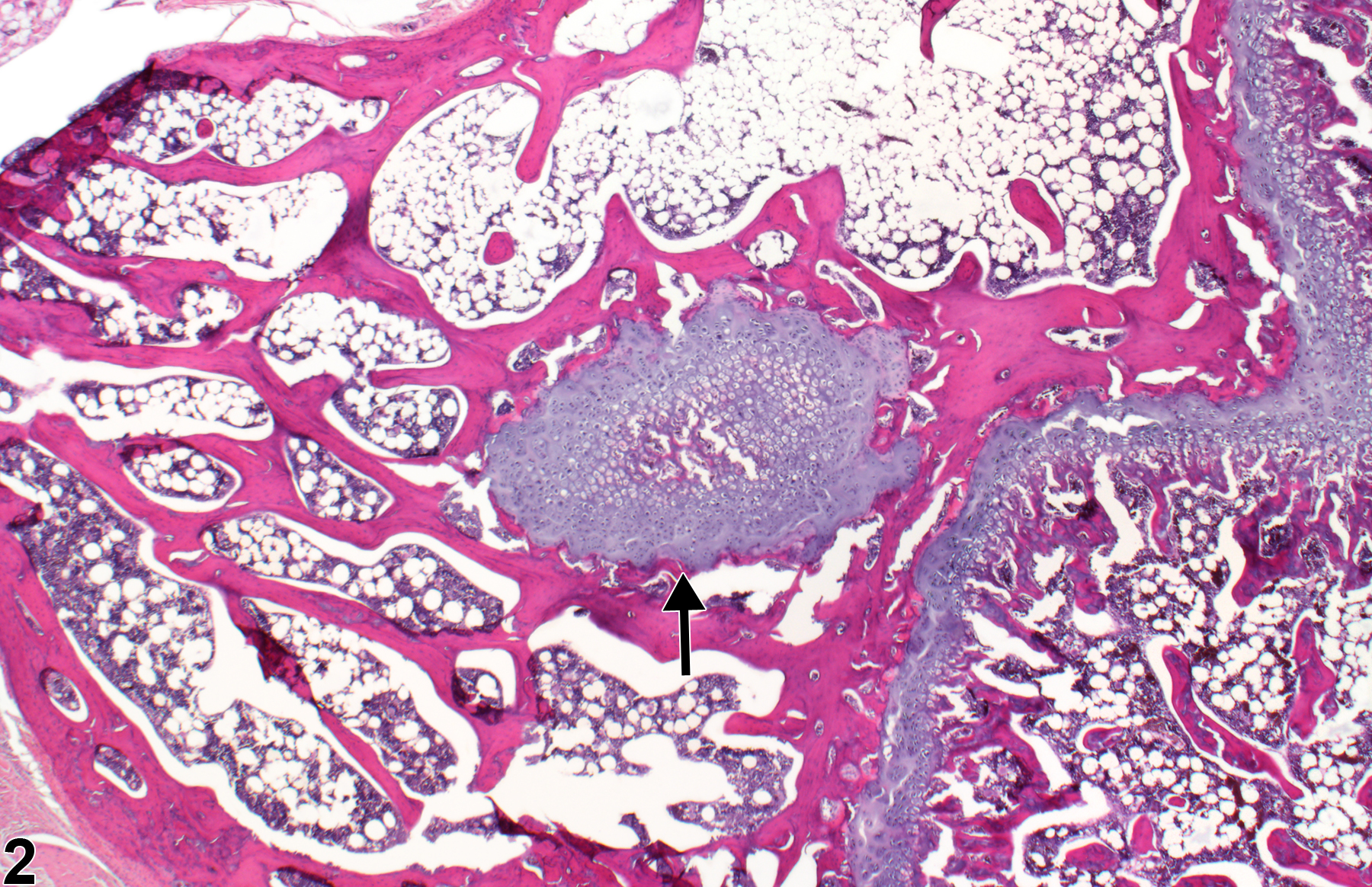Image of physeal dysplasia in the bone from a male F344/N rat in a subchronic study