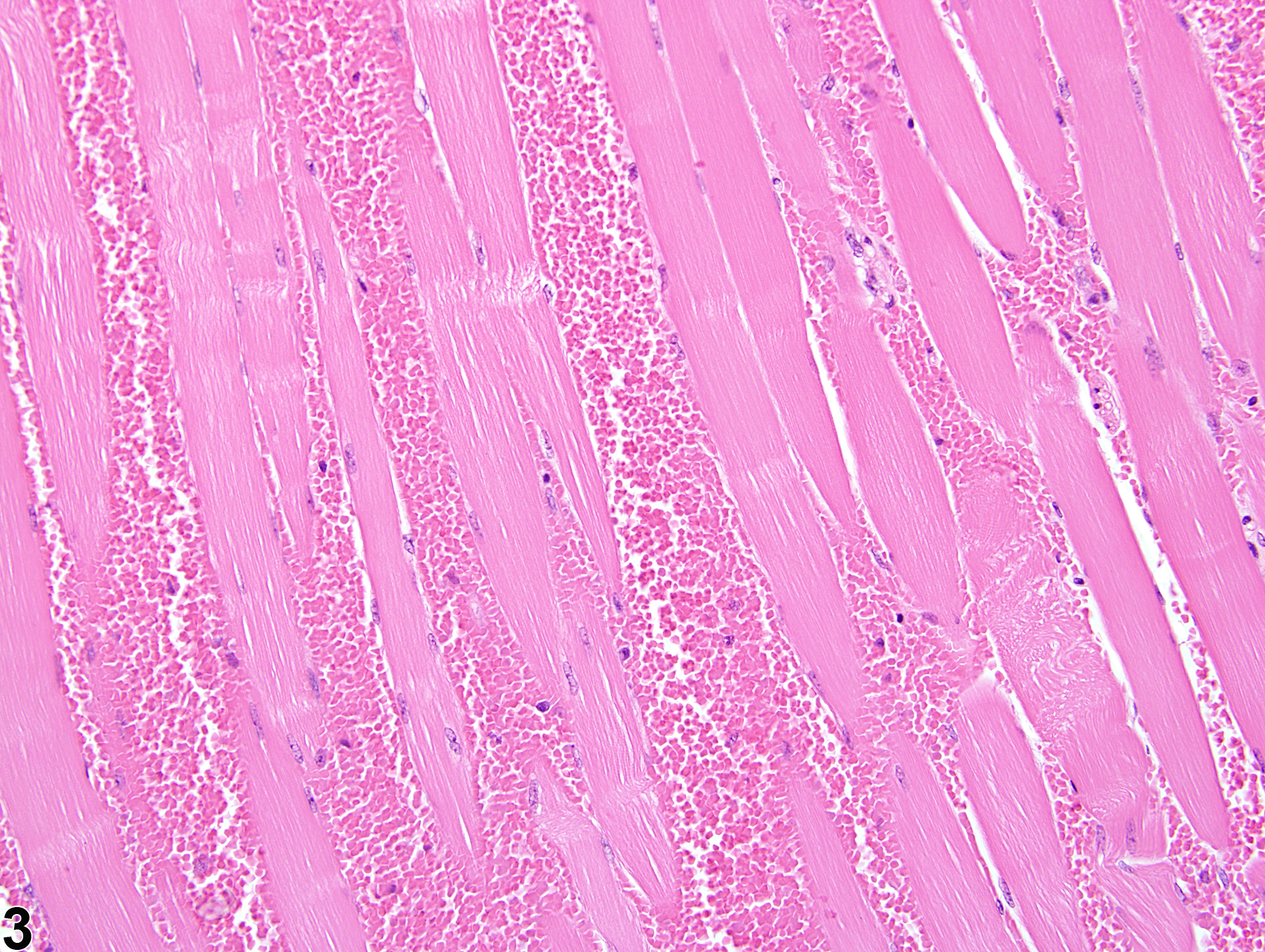 Image of hemorrhage in the skeletal muscle from a female B6C3F1/N mouse in a chronic study