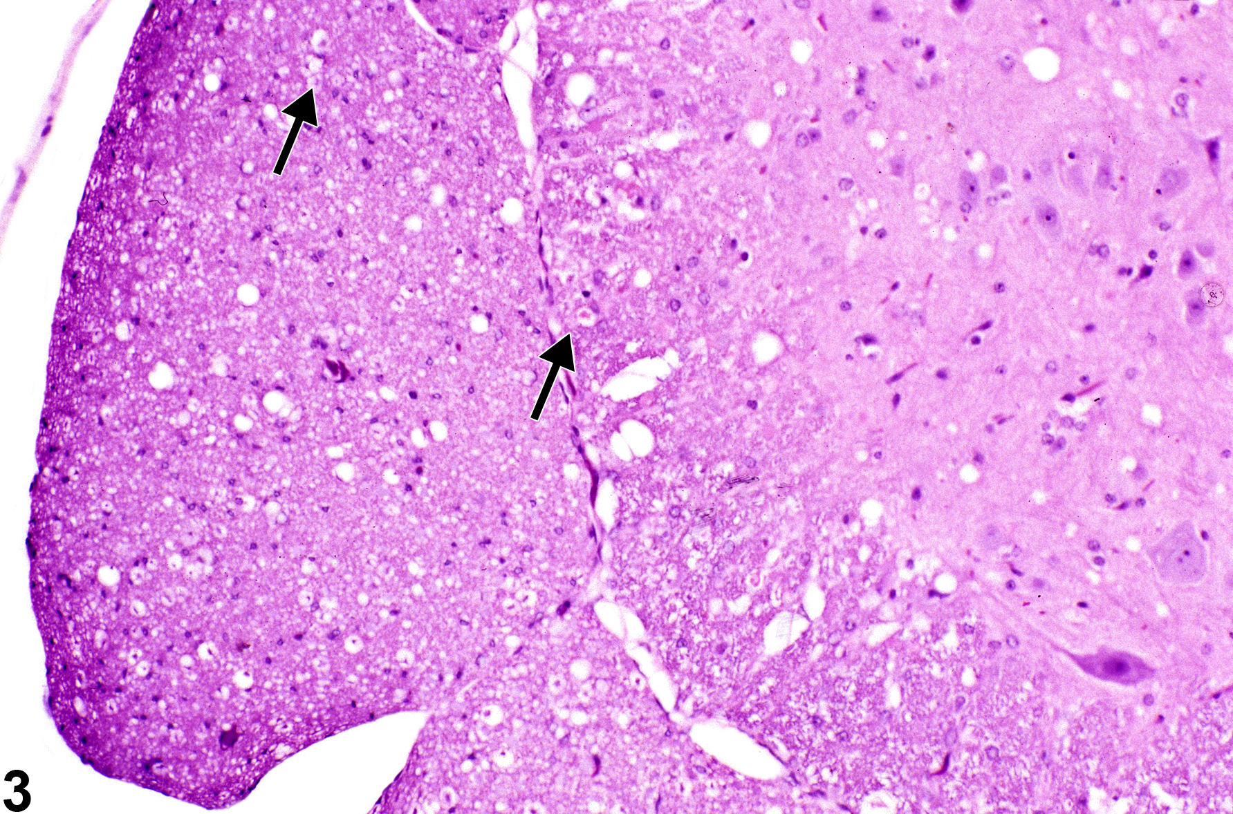 Image of axonopathy in the spinal cord from a male B6C3F1 mouse in a subchronic study