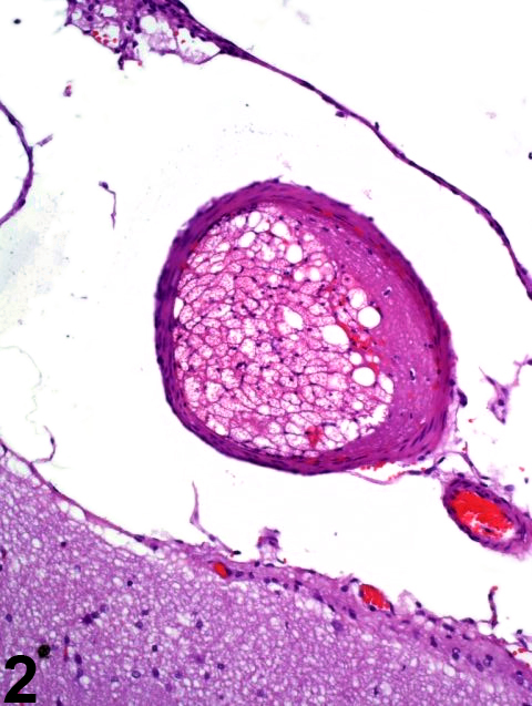 Image of necrosis in the brain from an F344/N rat