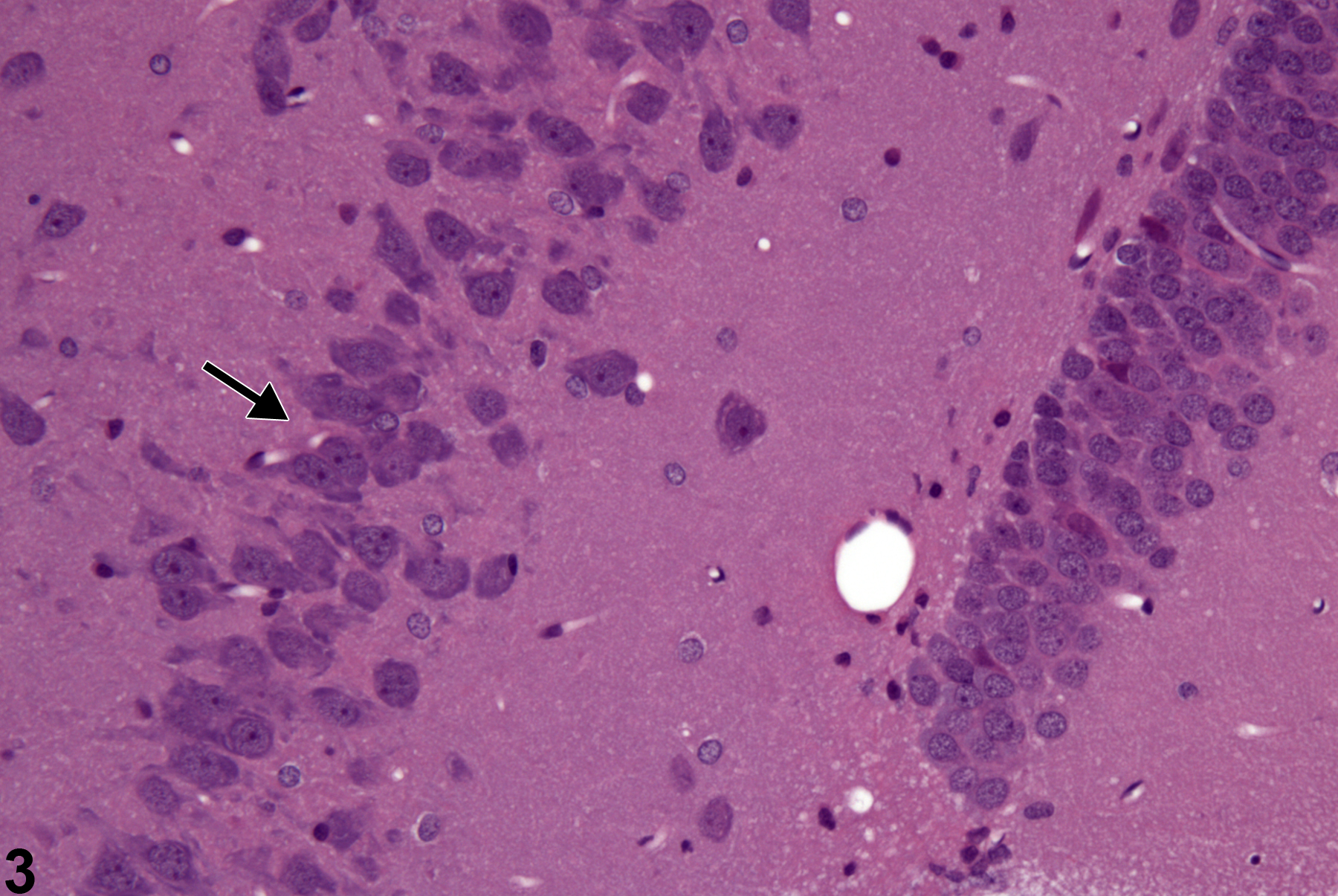 Image of Cell loss (normal comparison) in the Brain from a Male Not specified Rat in a Single dose  Study