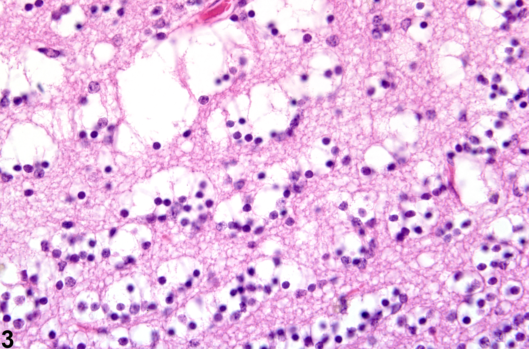 Image of degeneration in the brain from a female B6C3F1 mouse in a chronic study