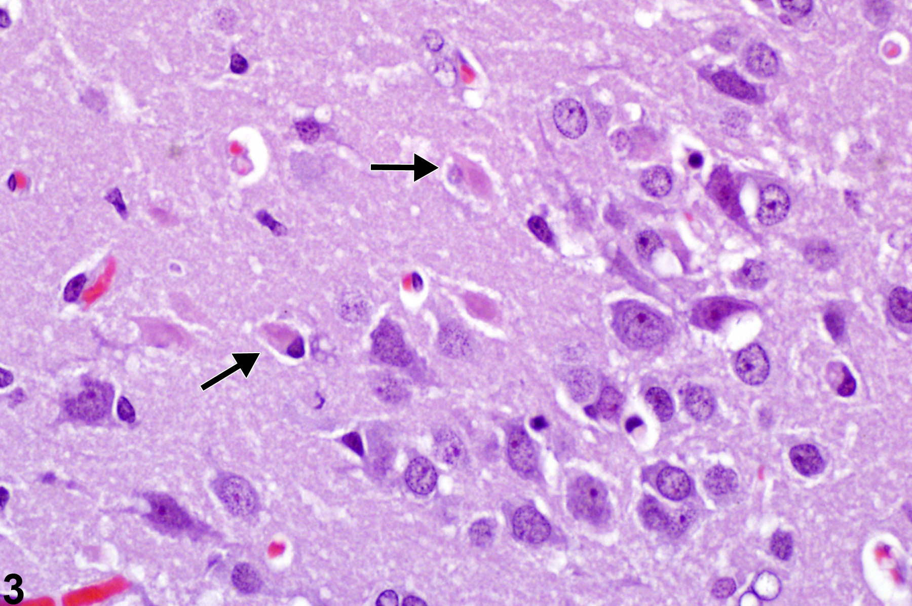 Image of necrosis in the brain from a male F344/N rat in a chronic study