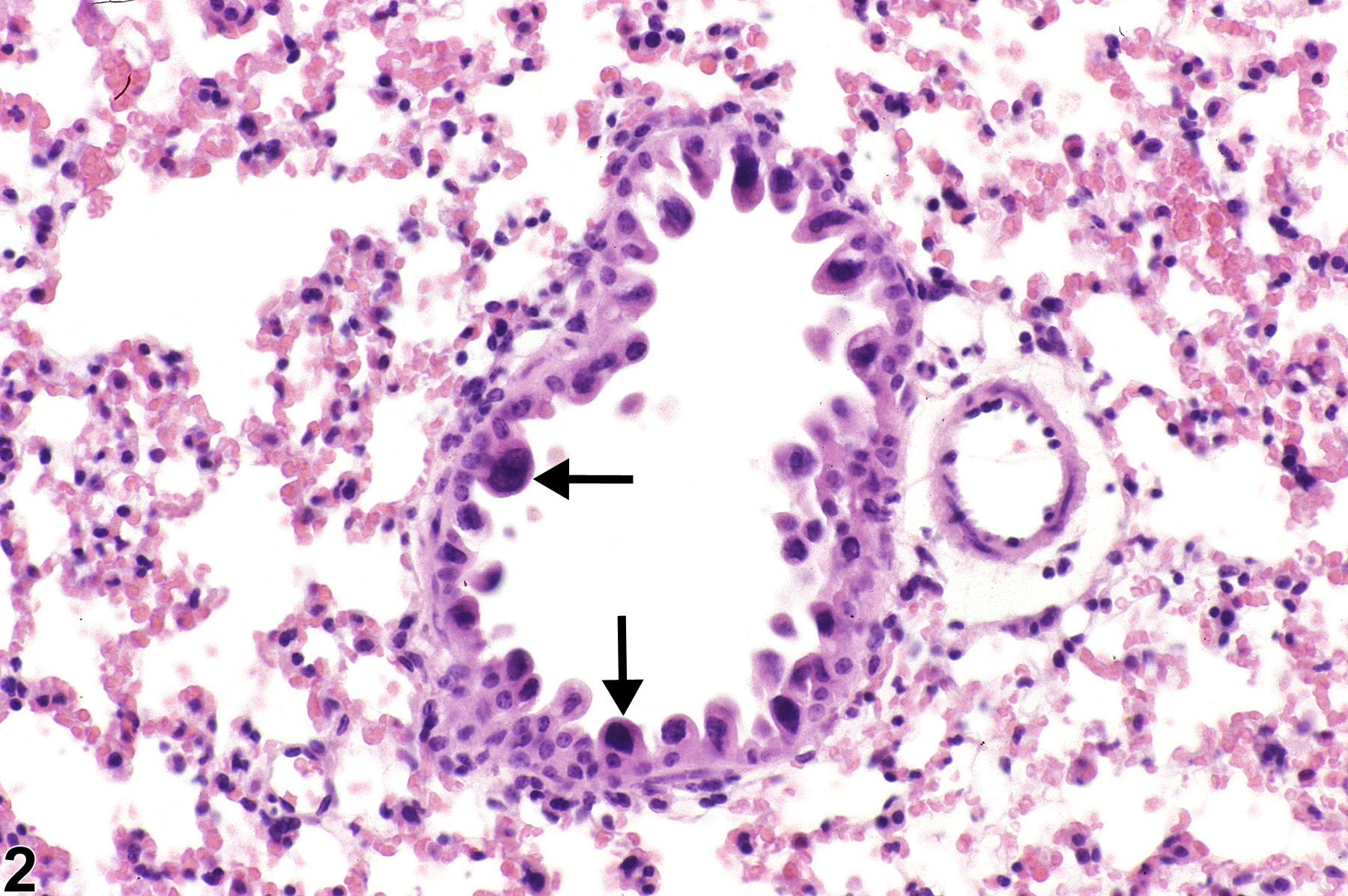 Image of atypia, cellular in the lung from a female B6C3F1/N mouse in a subchronic study