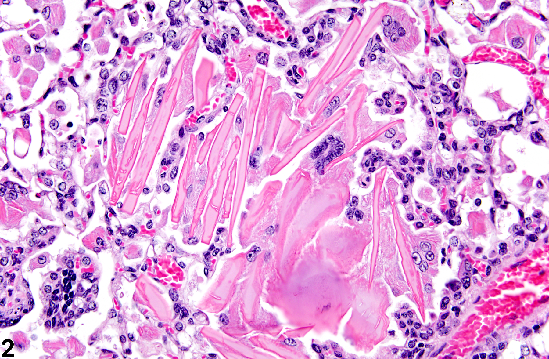 Image of crystals in the lung from a male B6C3F1/N mouse in a chronic study