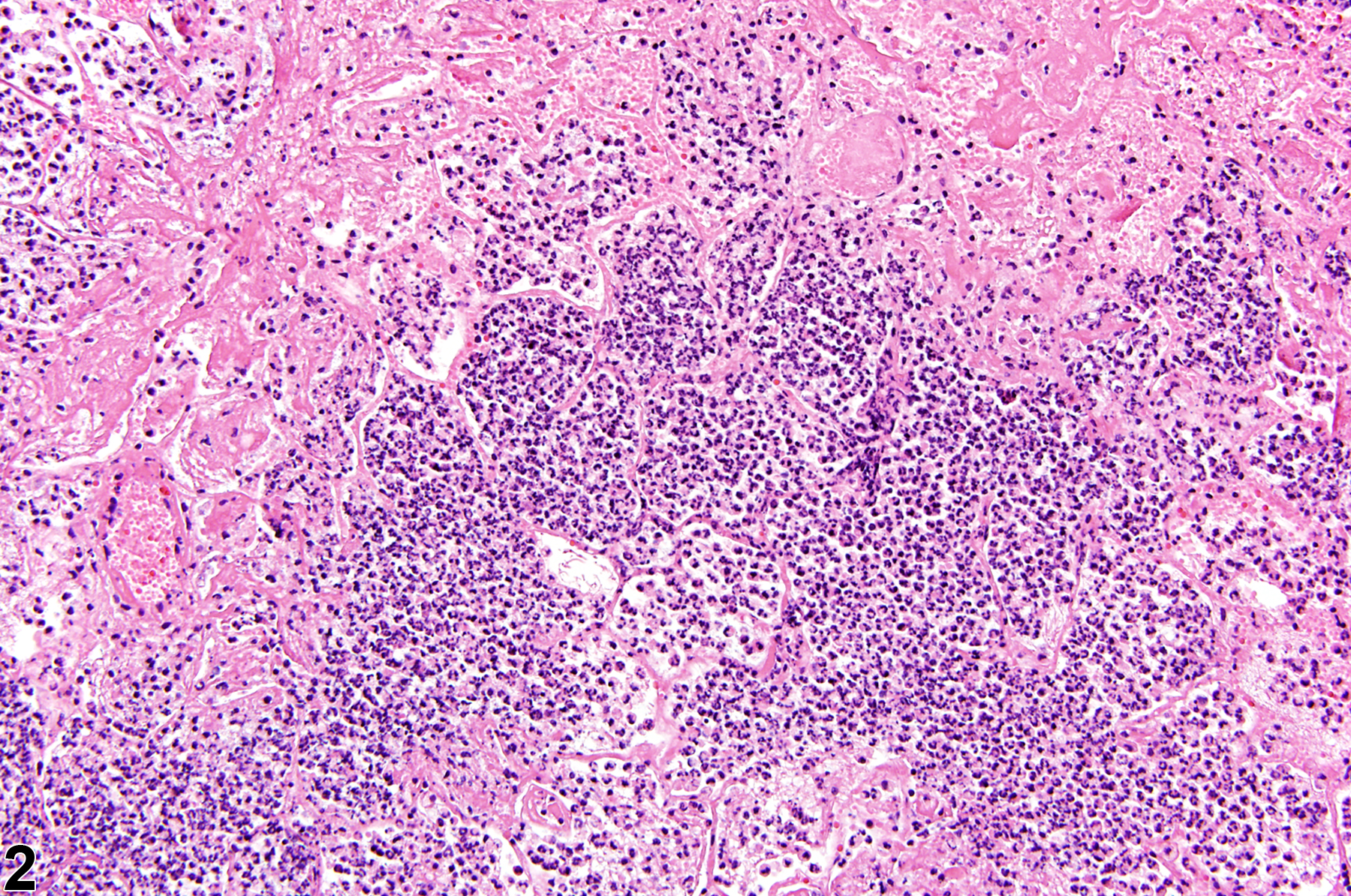 Image of epithelial necrosis in the lung from a male B6C3F1/N mouse in a subchronic study