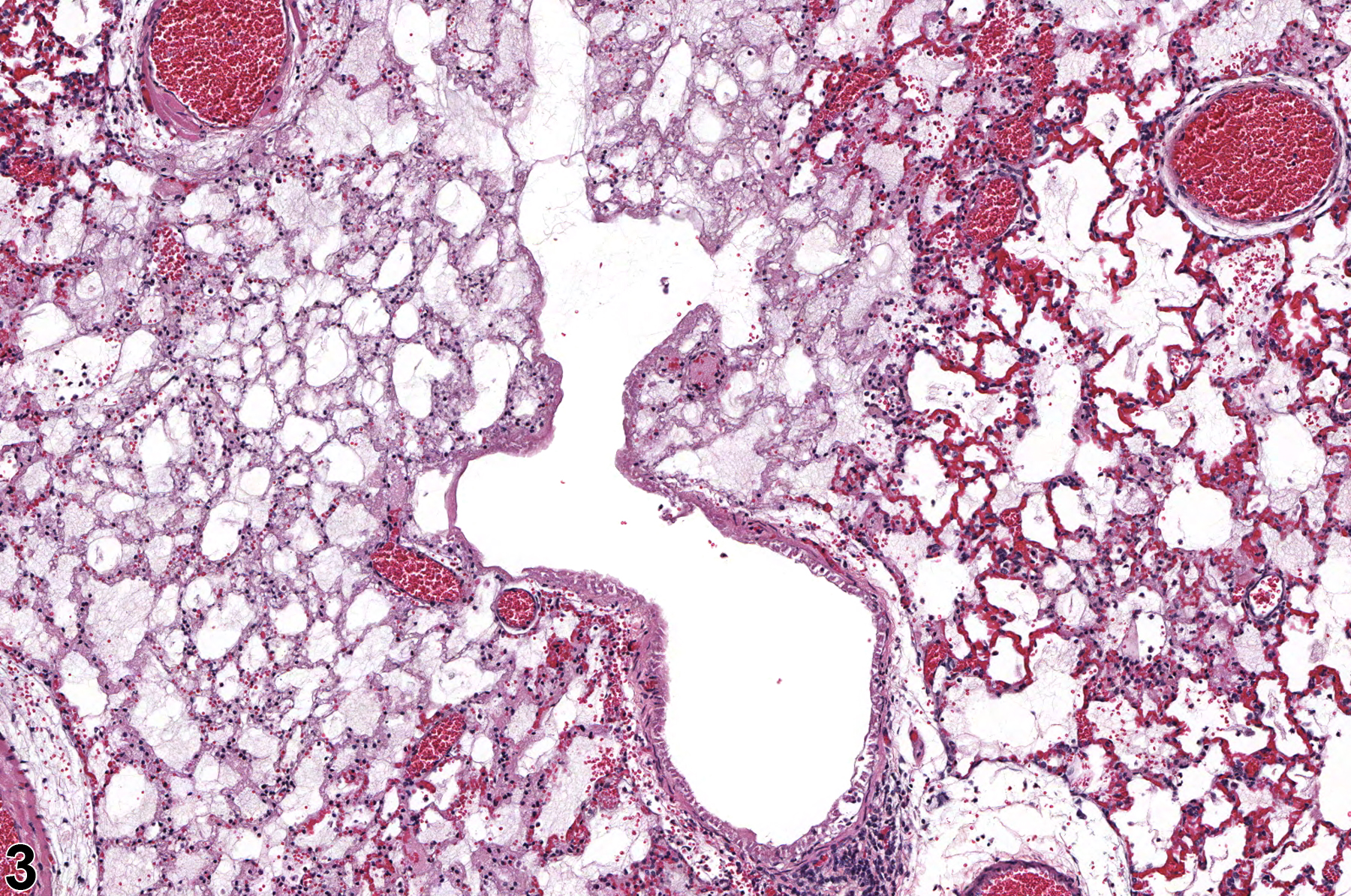 Image of epithelial necrosis in the lung from a female F344/N rat in a subchronic study