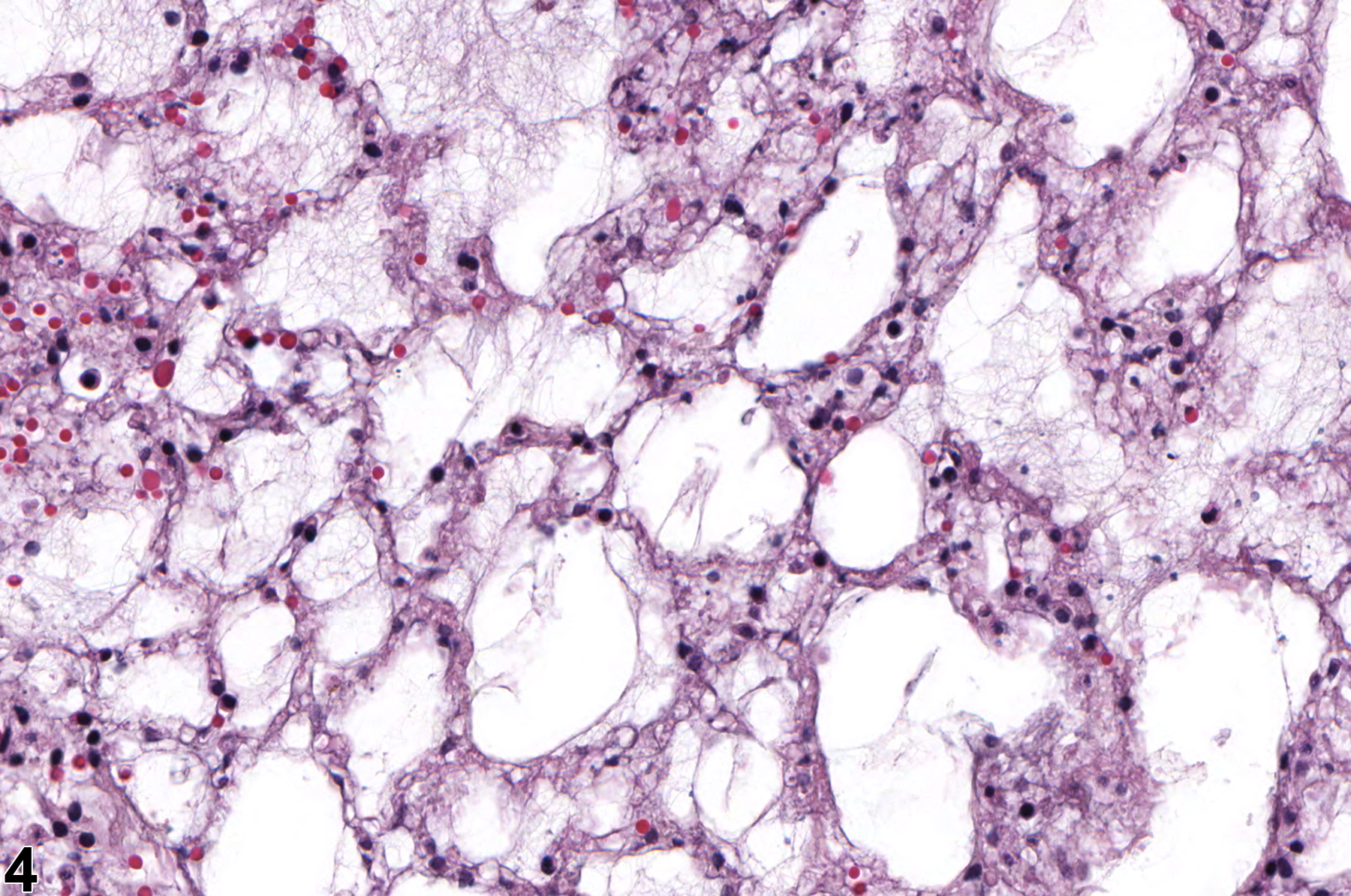 Image of epithelial necrosis in the lung from a female F344/N rat in a subchronic study