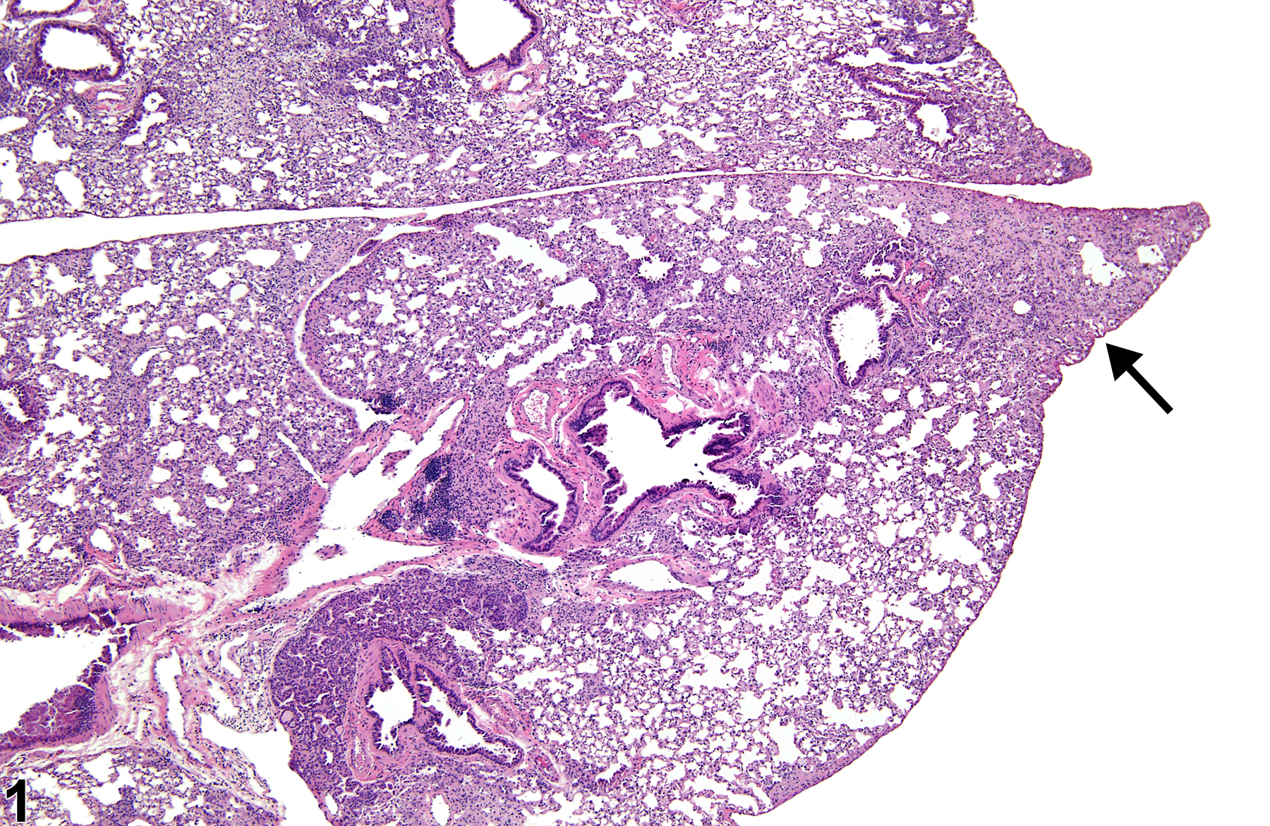 Image of fibrosis in the lung from a mouse