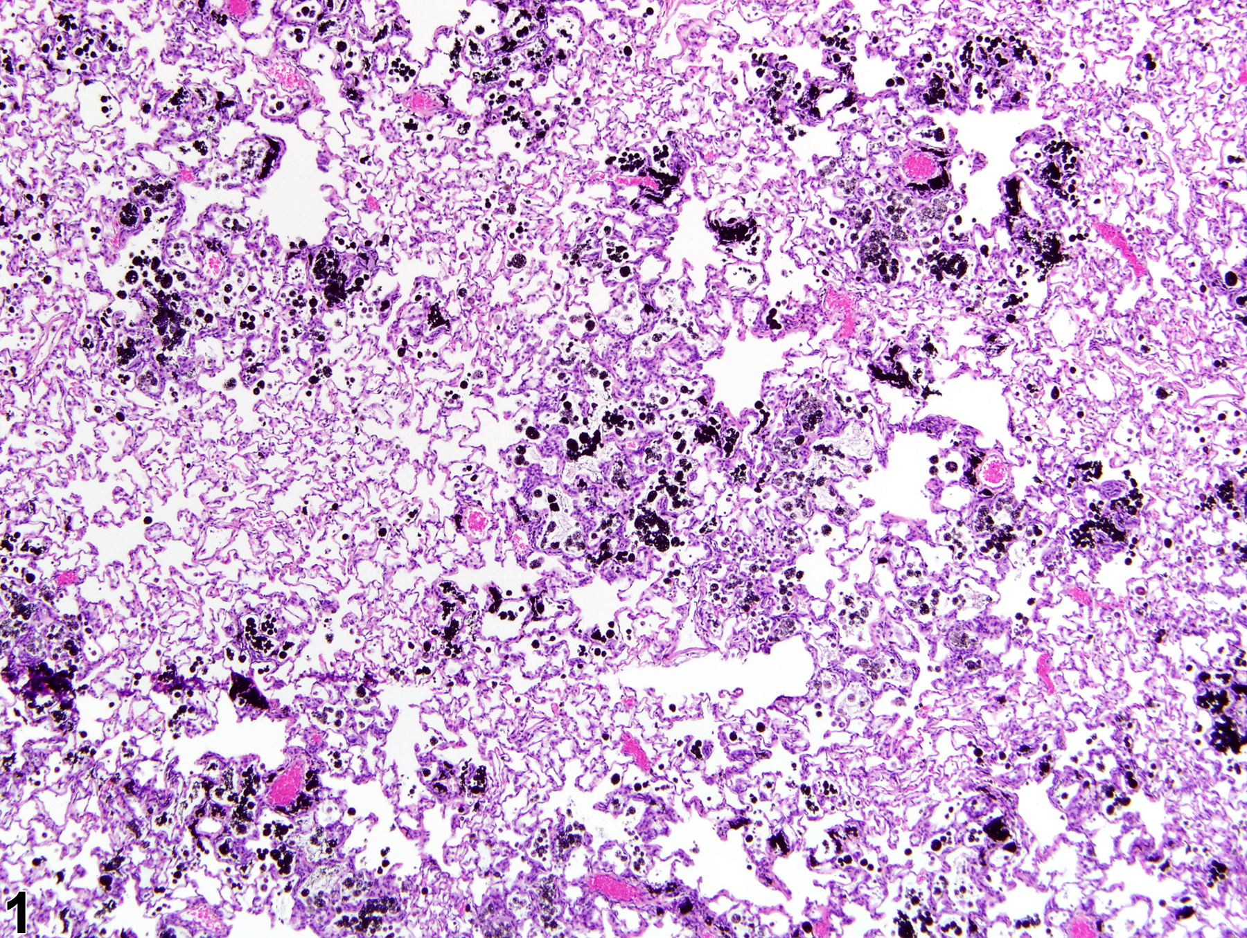 Image of foreign material in the lung from a male Harlan Sprague-Dawley rat in a chronic study