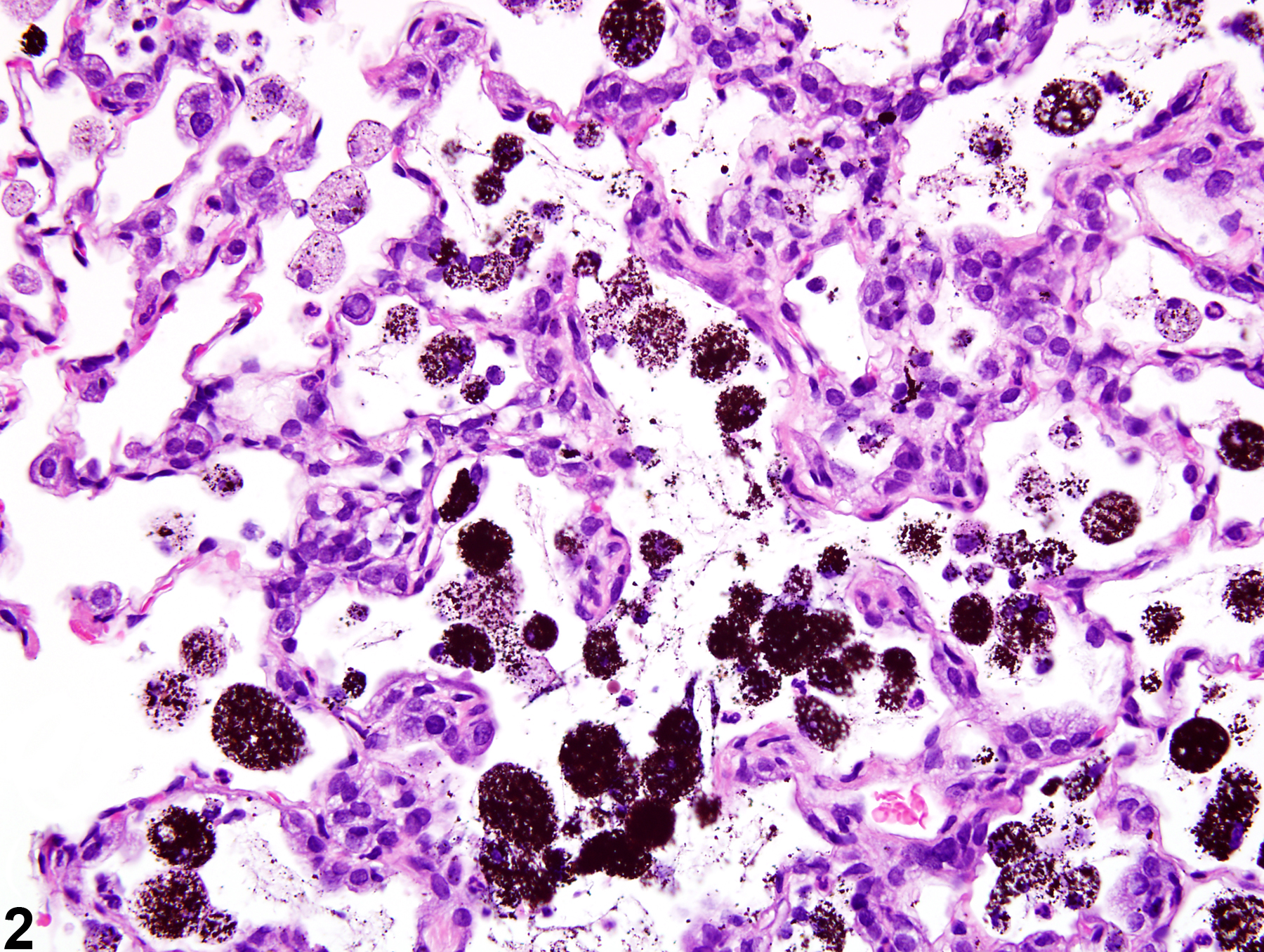 Image of foreign material in the lung from a male Harlan Sprague-Dawley rat in a chronic study