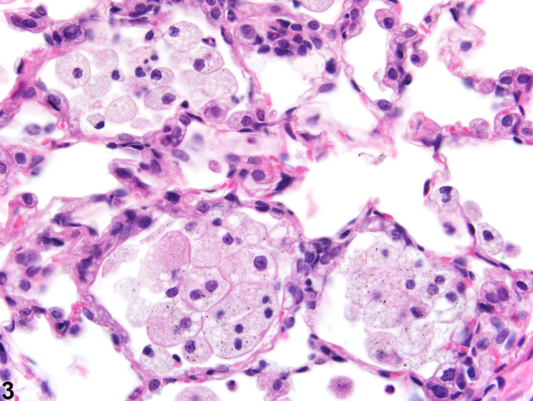 Image of foreign material in the lung from a male Harlan Sprague-Dawley rat in a subchronic study