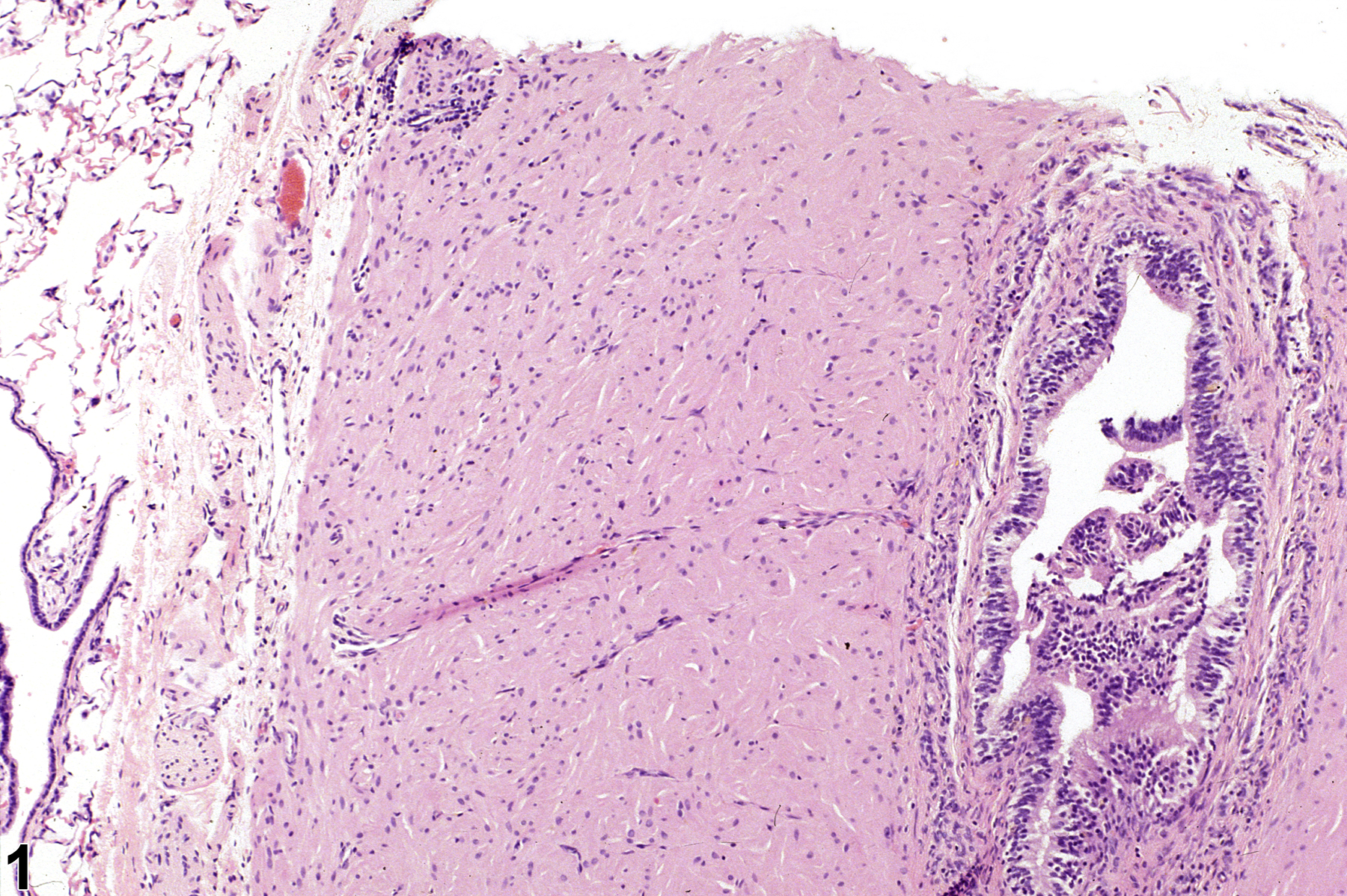 Image of hypertrophy, smooth muscle in the lung from a male F344/N rat in a chronic study