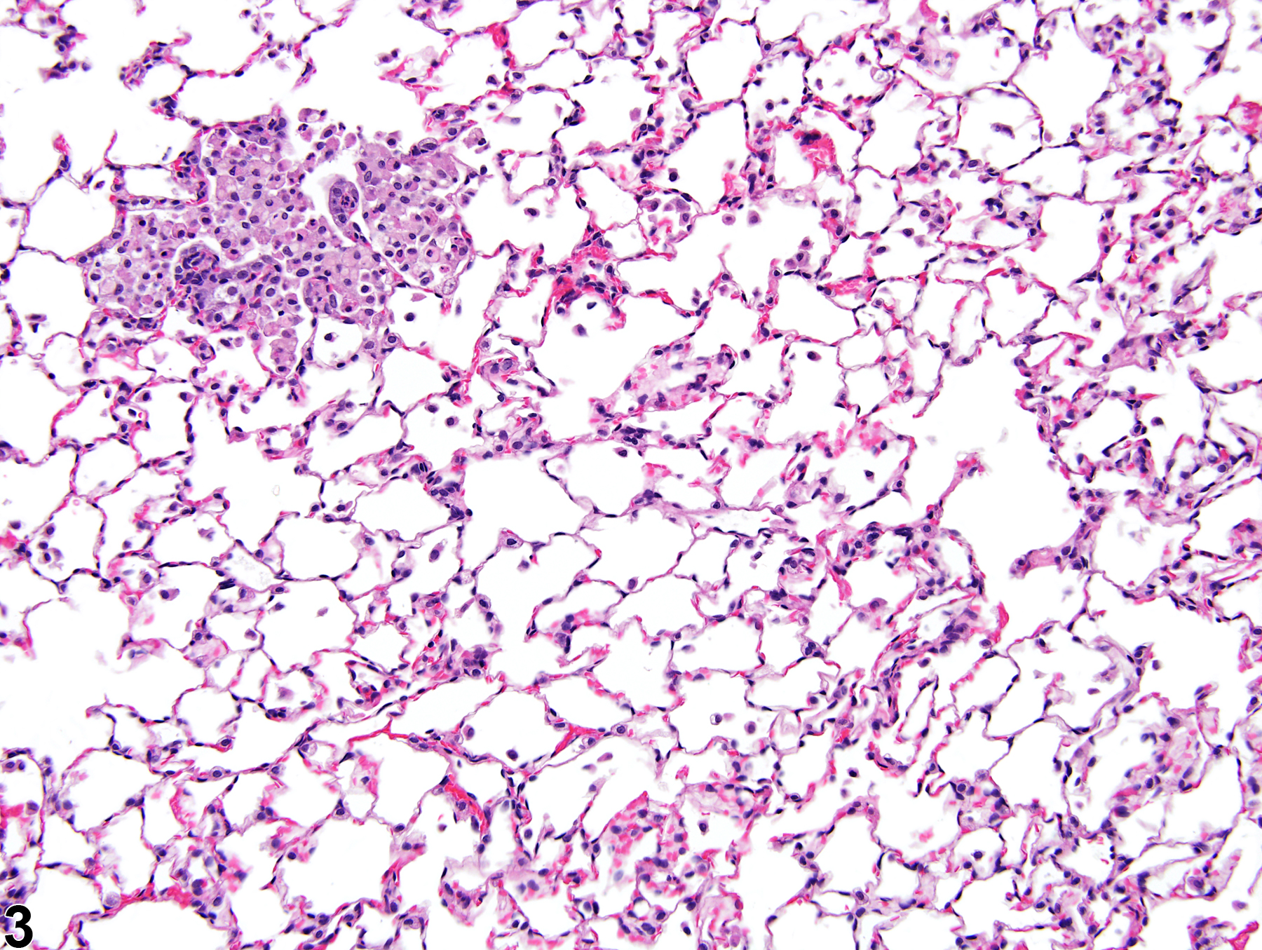 Image of infiltration cellular, histiocyte in the lung from a male F344/NTac rat in a subchronic study