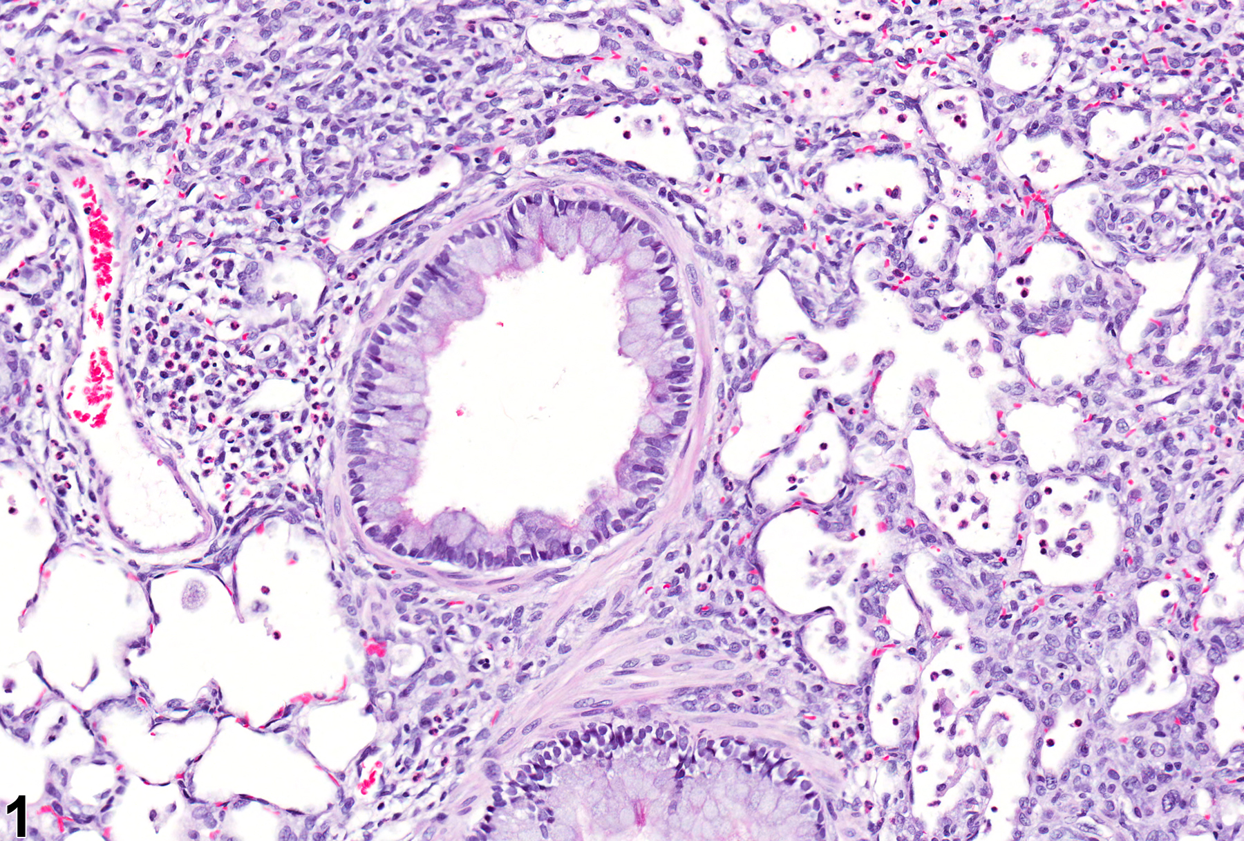 Image of bronchiolar goblet cell metaplasia in the lung from a male Sprague-Dawley rat in a acute study