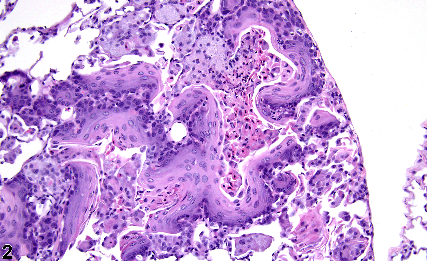 Image of alveolar squamous metaplasia in the lung from a female Harlan Sprague-Dawley rat in a subchronic study