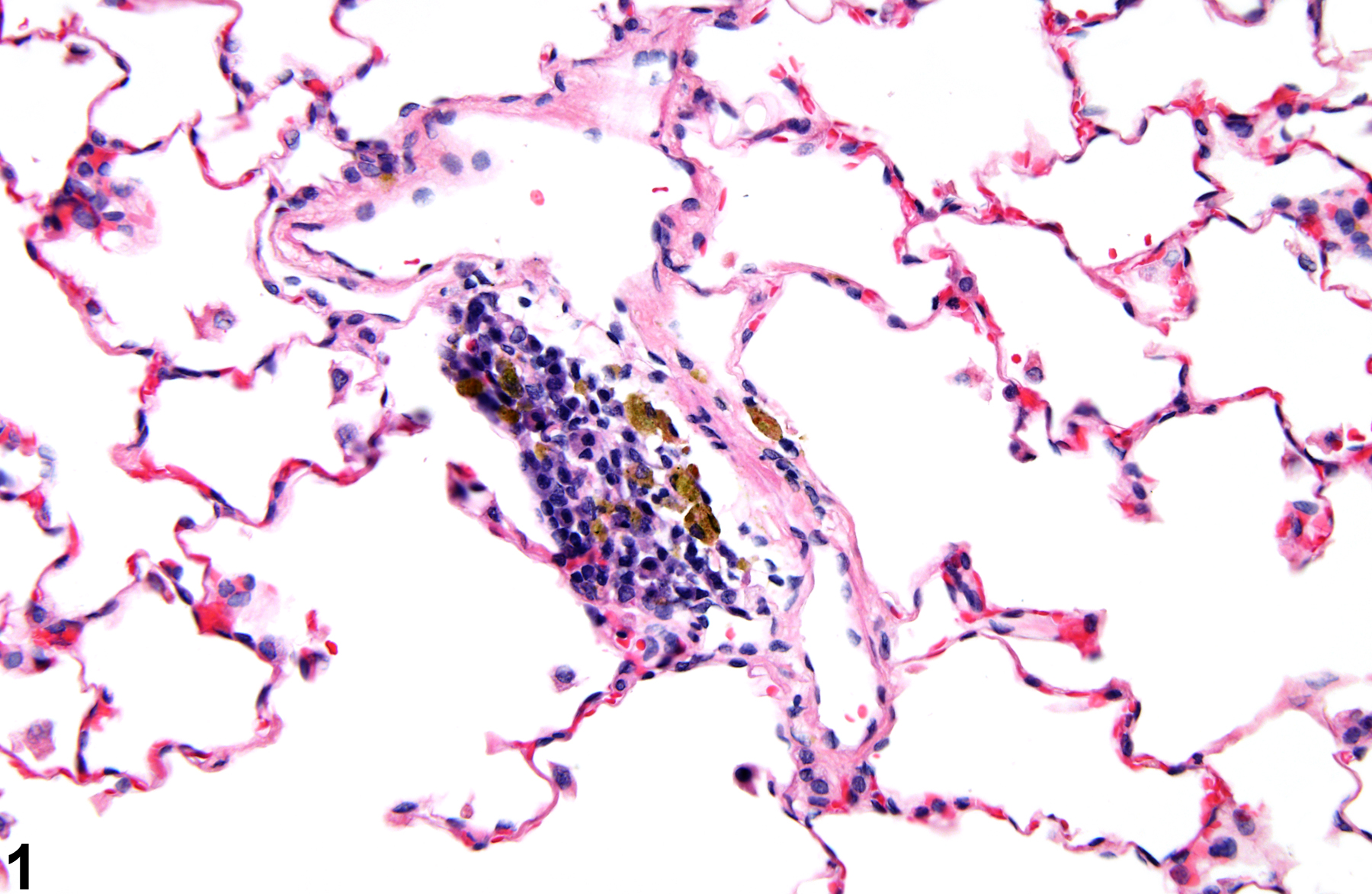 Image of alveolar pigment in the lung from a female Harlan Sprague-Dawley rat in a chronic study