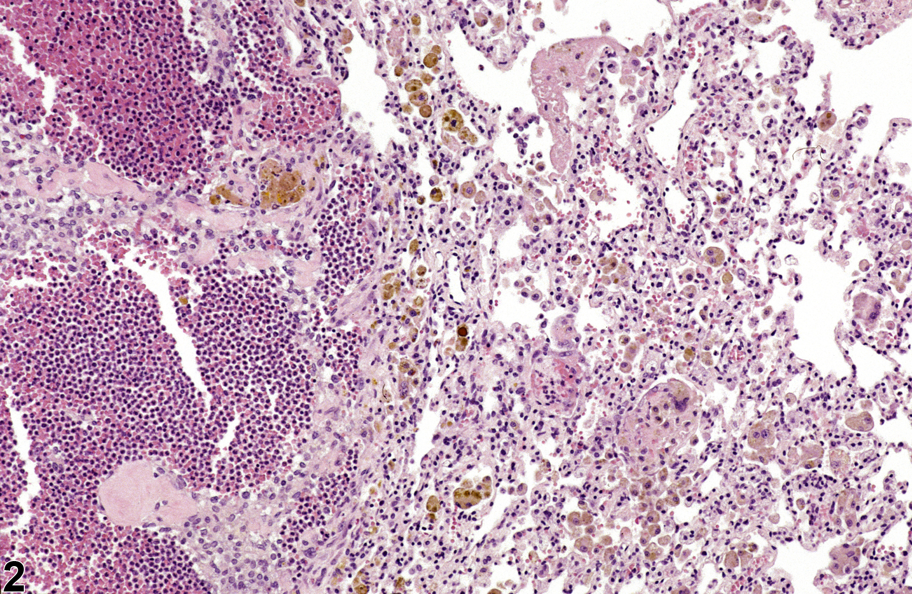 Image of alveolar pigment in the lung from a male F344/N rat in a chronic study