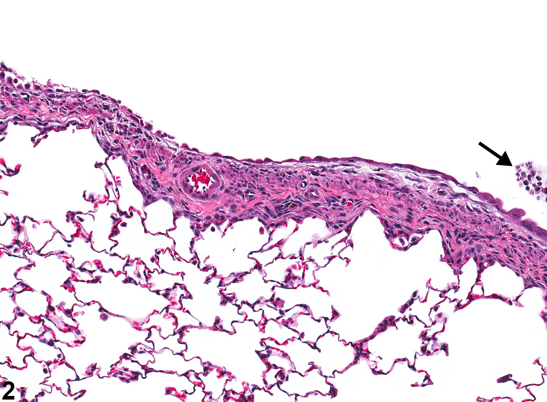 Image of bronchiolar regeneration in the lung from a male Wistar Han rat in a acute study