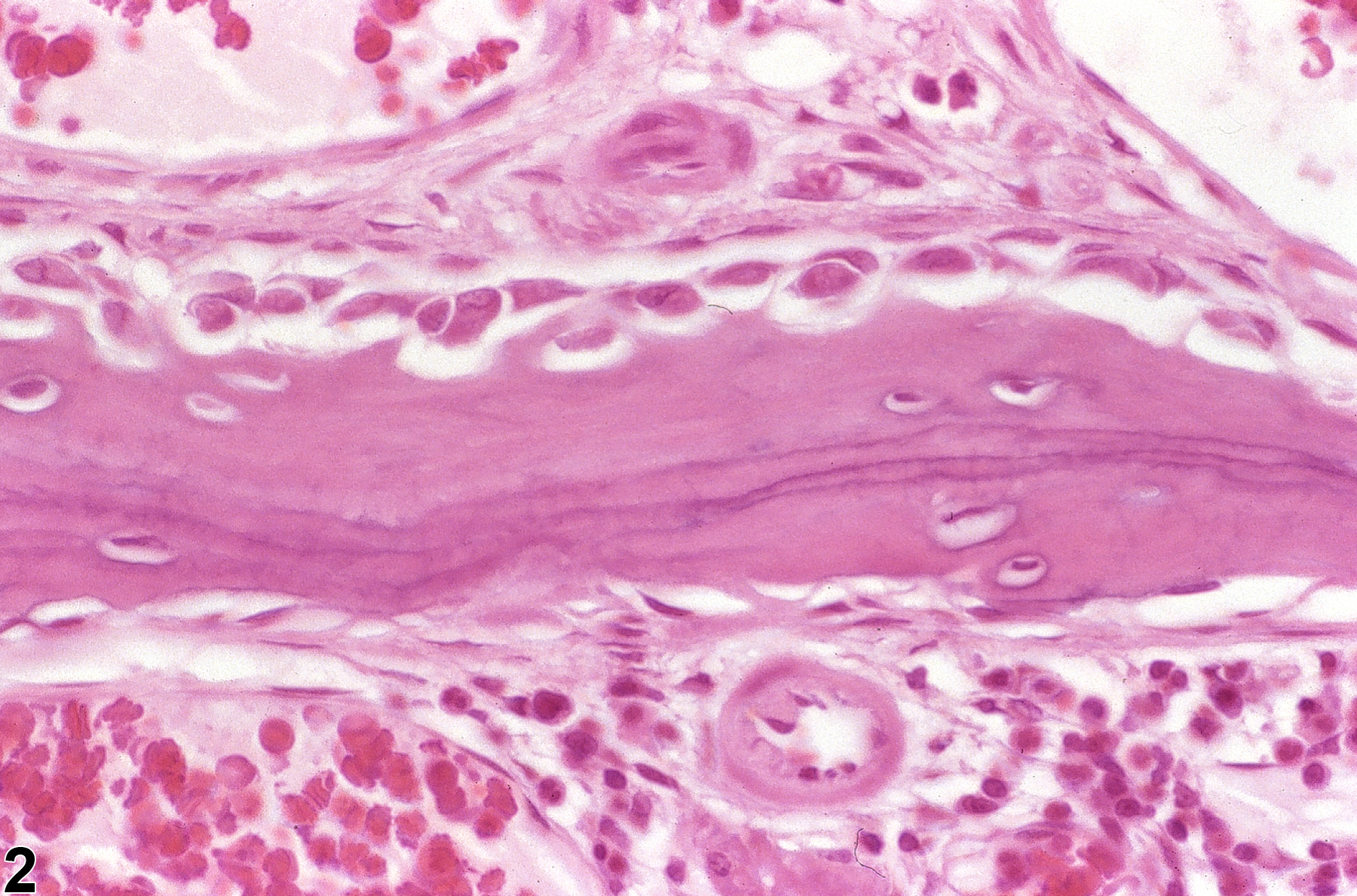 Image of periosteal proliferation in the nose, bone from a male F344/N rat in a chronic study