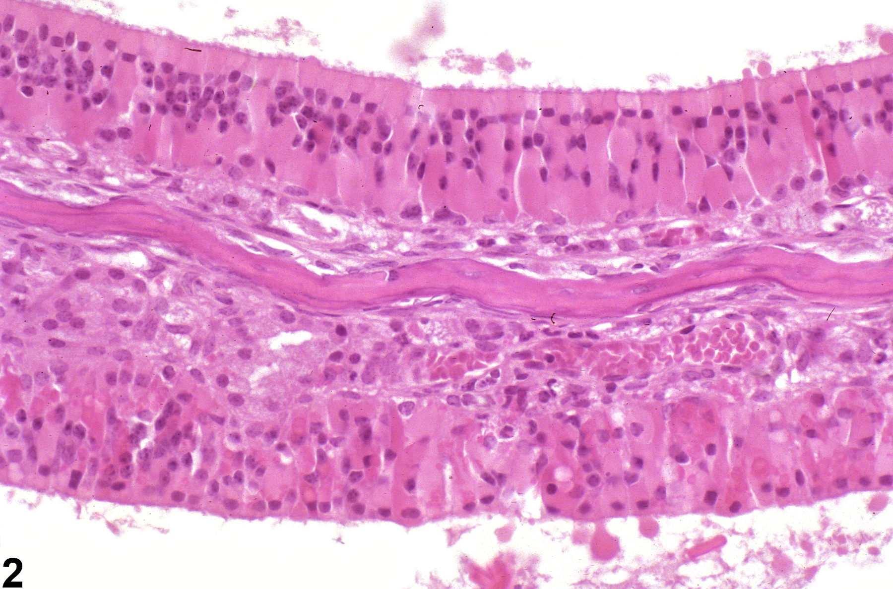 Image of accumulation, hyaline droplet in the nose, olfactory epithelium from a female B6C3F1/N mouse in a chronic study