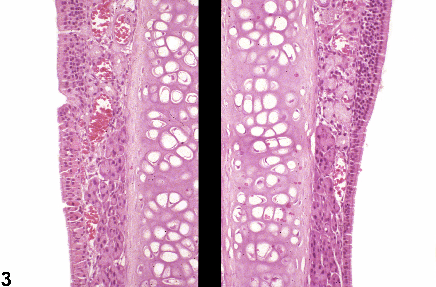 Image of accumulation, hyaline droplet in the nose, respiratory epithelium from a female B6C3F1/N mouse in a subchronic study