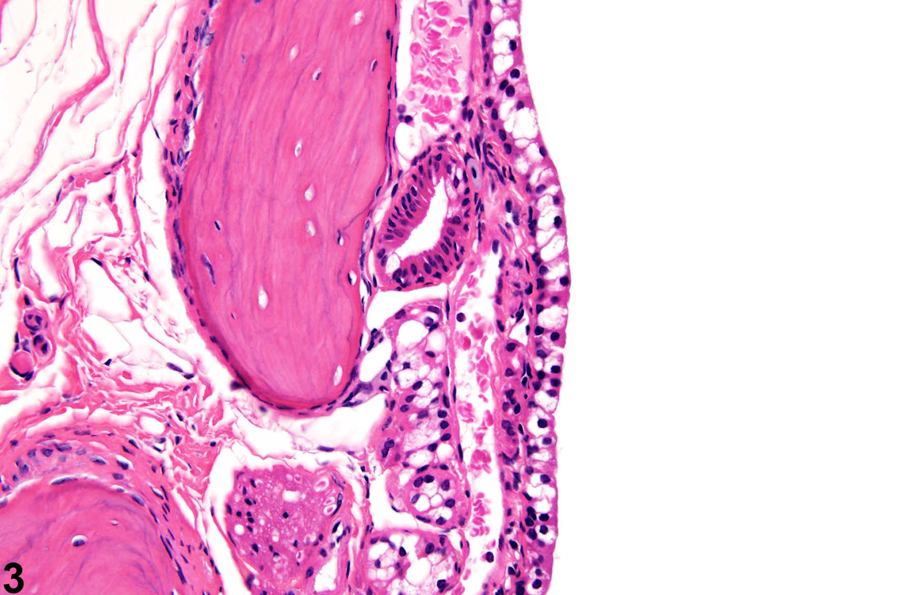 Image of degeneration in the nose, respiratory epithelium from a male B6C3F1/N mouse in a chronic study