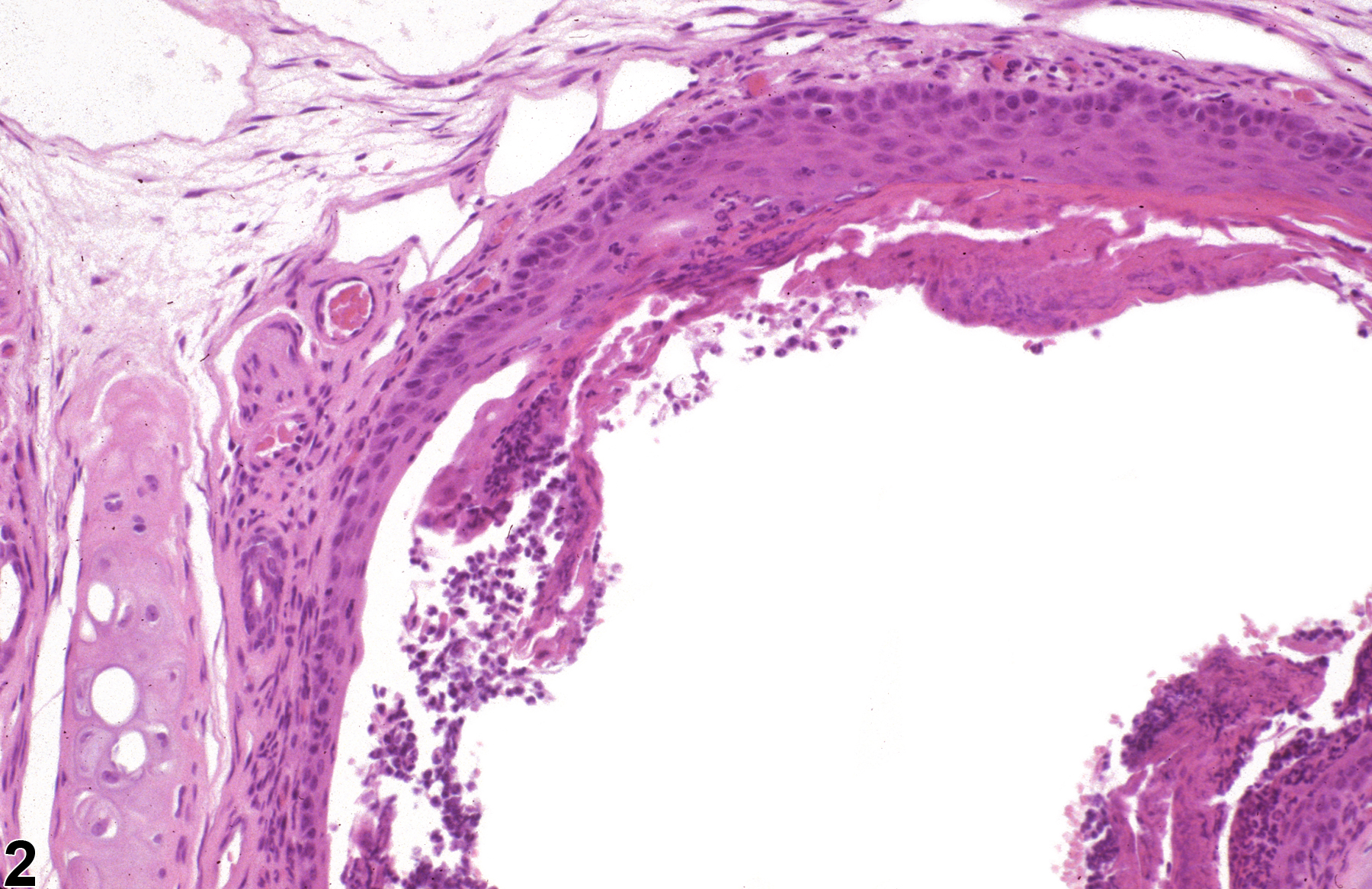 Image of metaplasia, squamous in the nose, respiratory epithelium from a female B6C3F1/N mouse in a chronic study