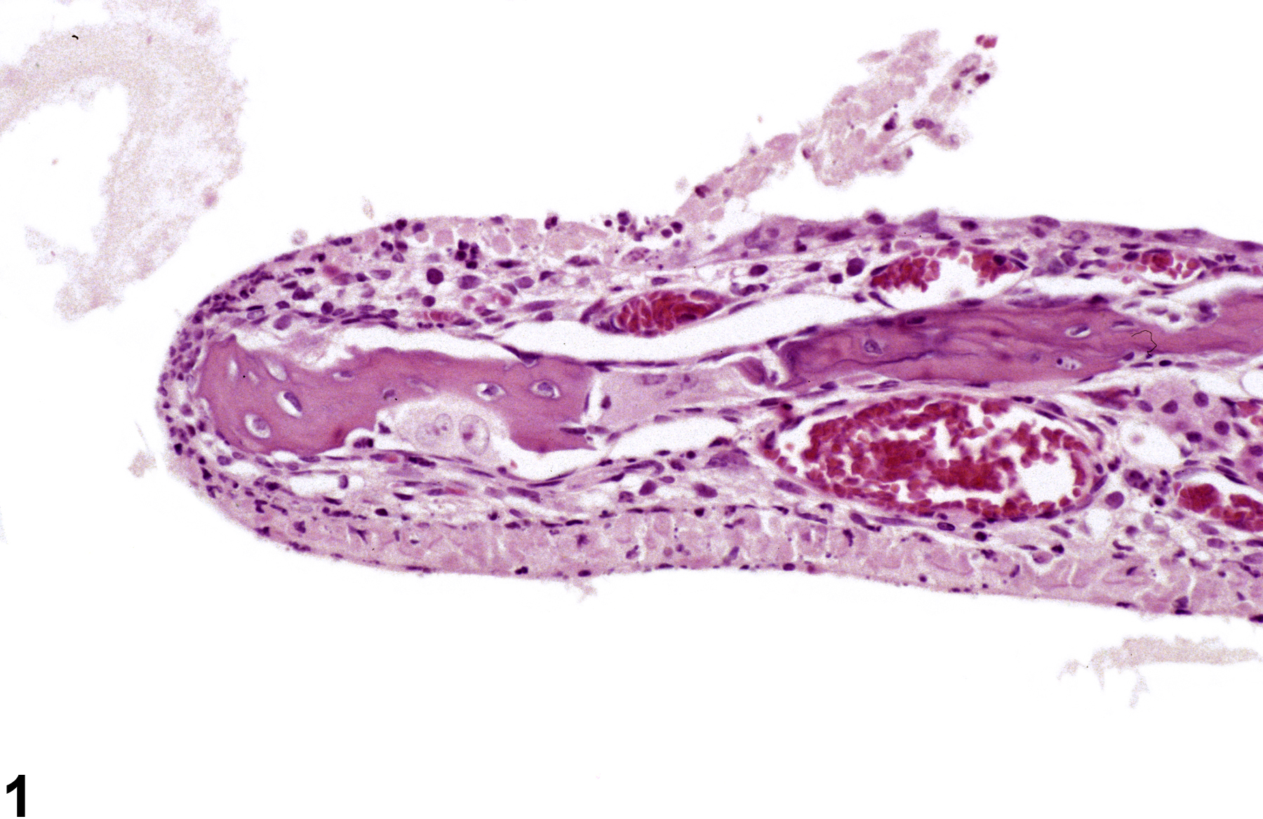 Image of necrosis in the nose, transitional epithelium from a female B6C3F1/N mouse in a subchronic study
